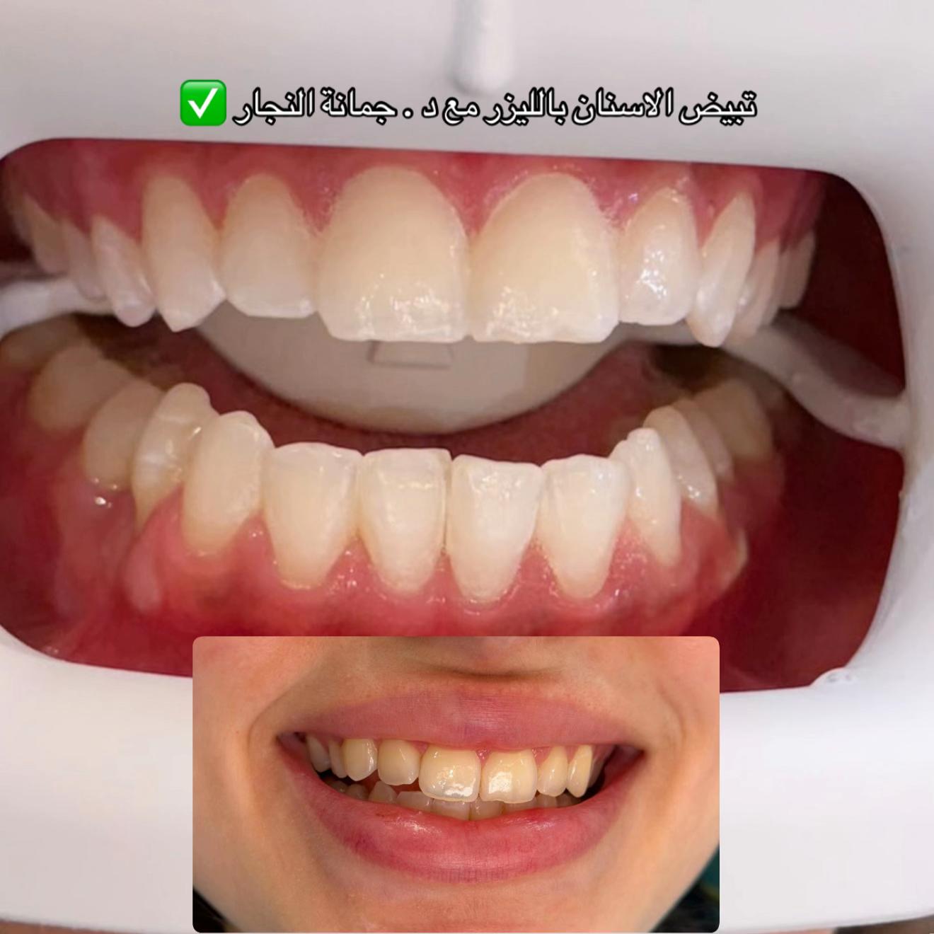 @مراس فرع النزهة