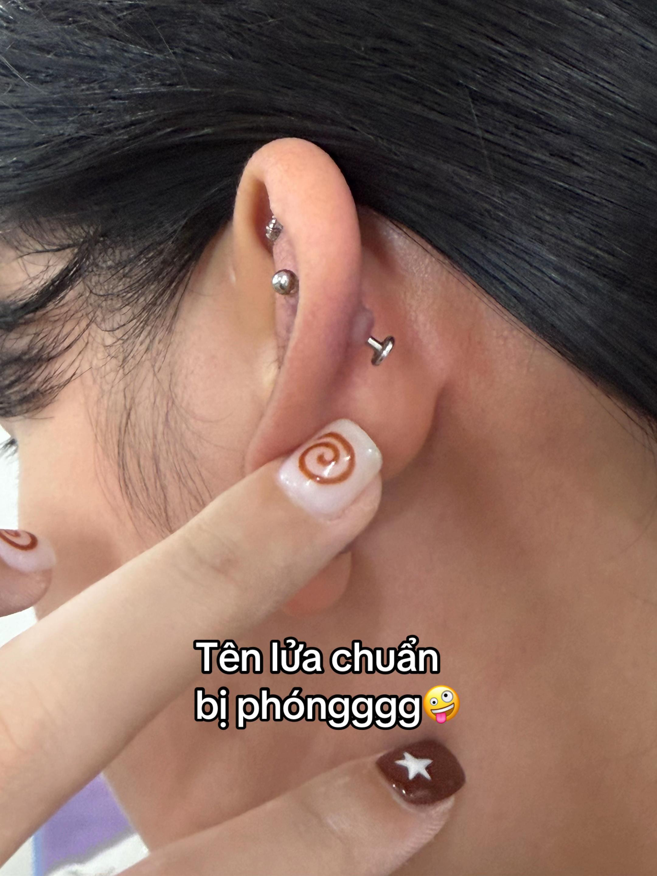 @&Aacute;nh Xokhuyen🪡