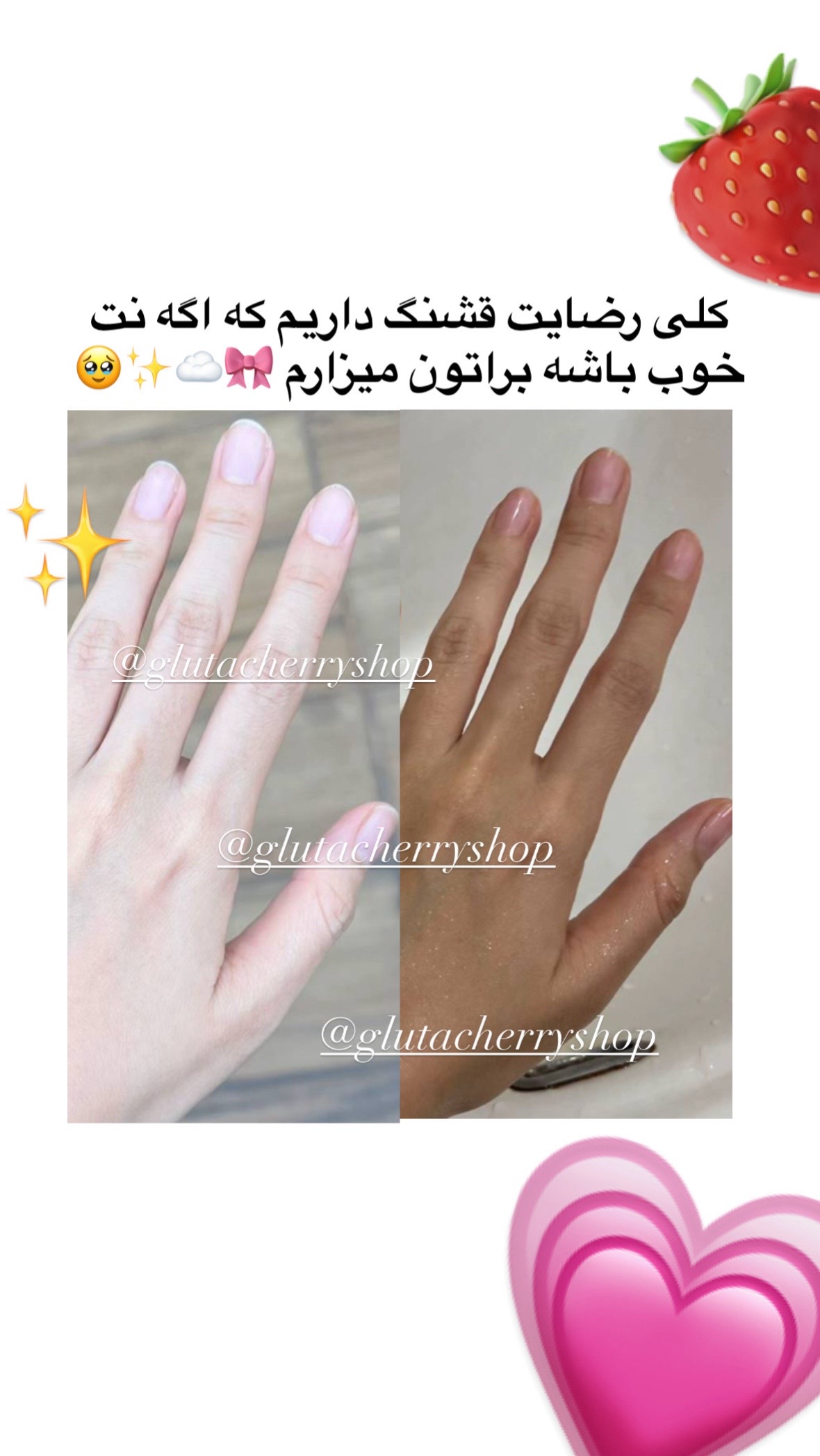 @گلوتاچری شاپ