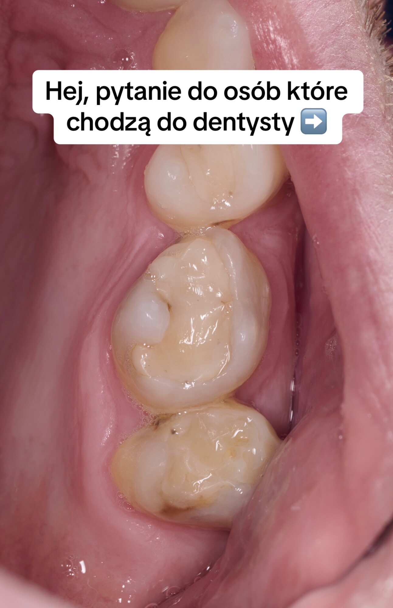 @Anna 🦷 dentystka