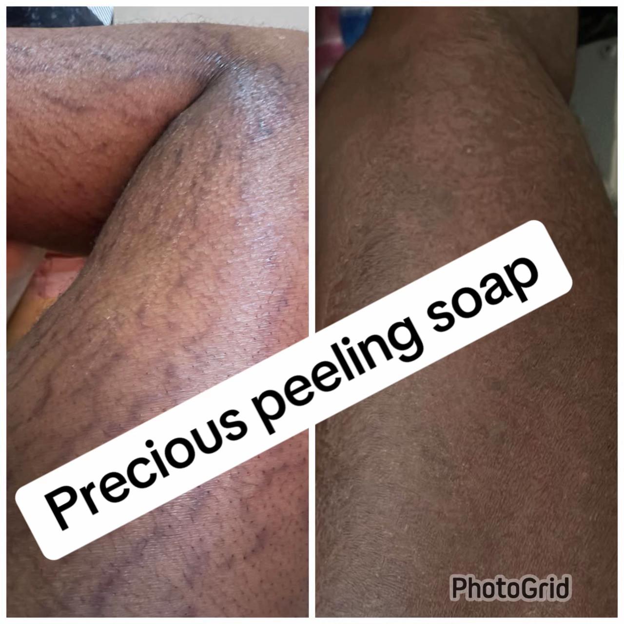 @@ Precious peeling soap