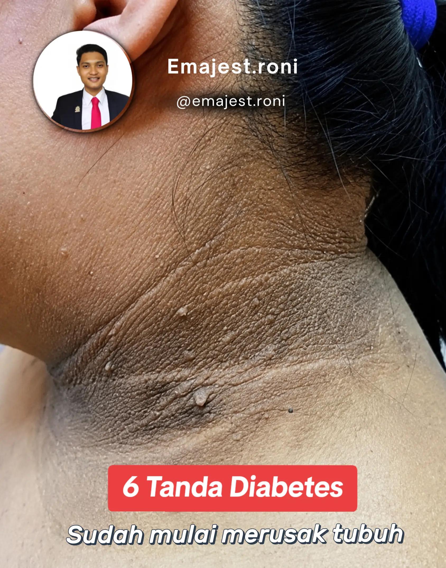 @Emajest.Roni