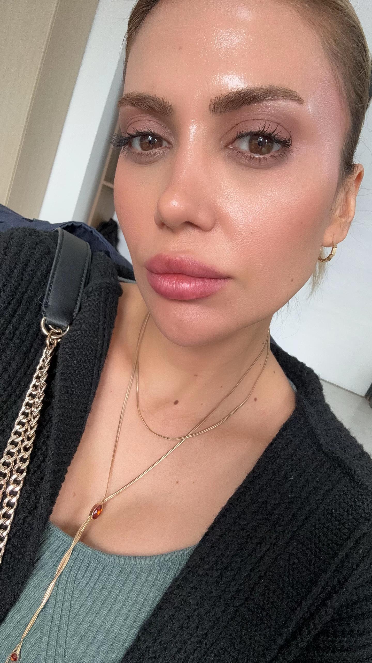 @Caglaca