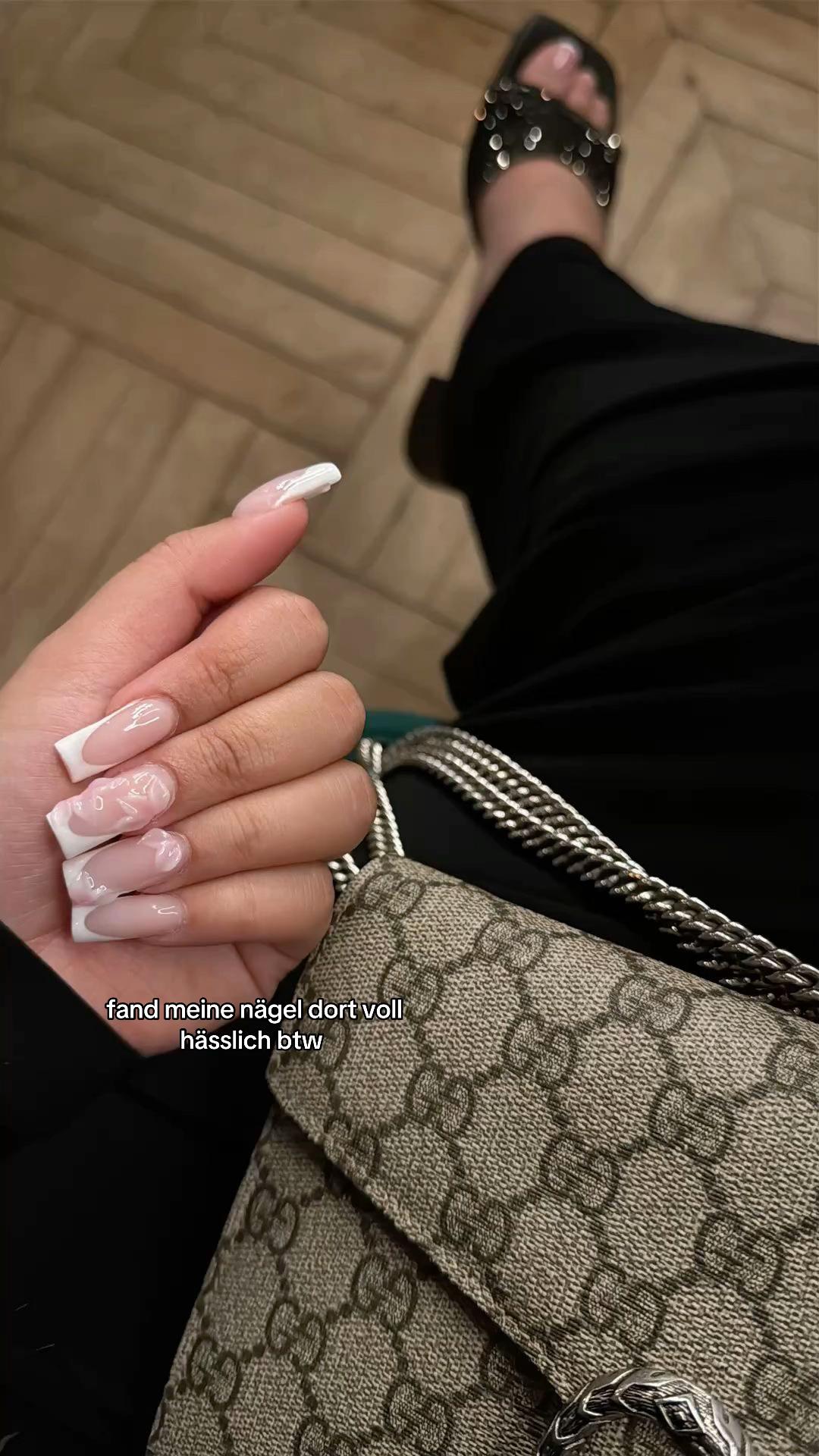 @user4435177