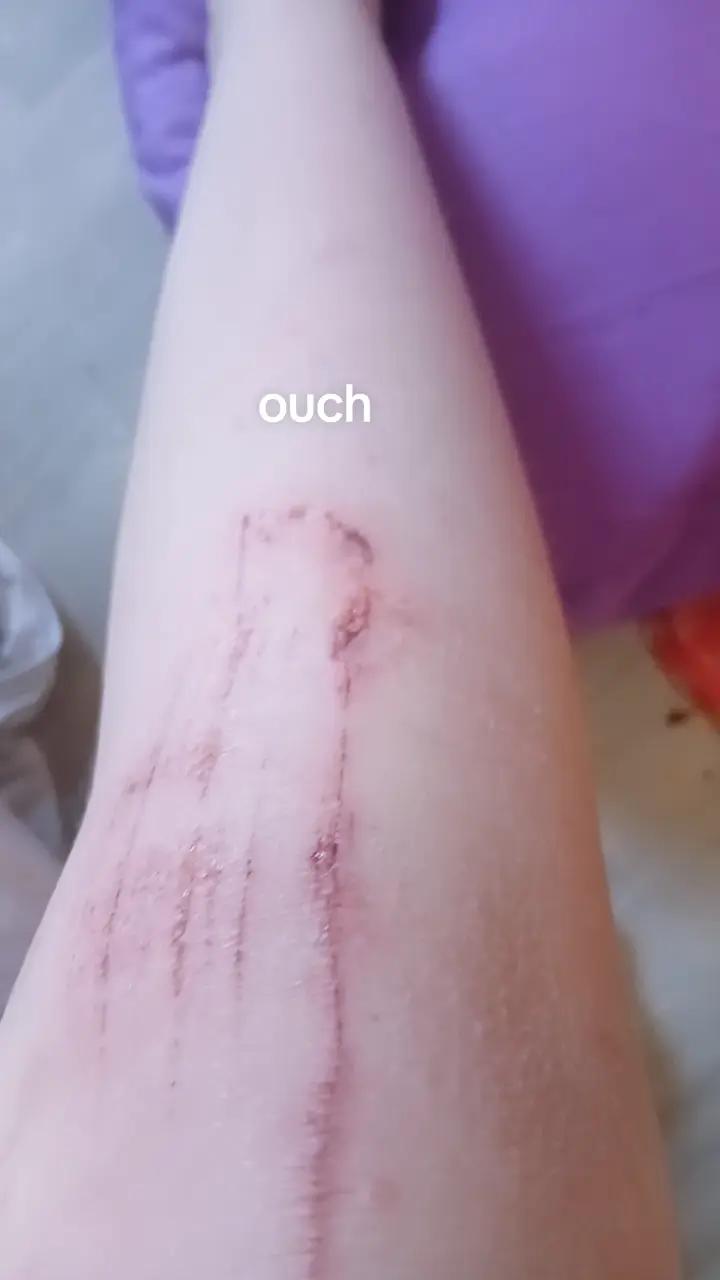 @kaci