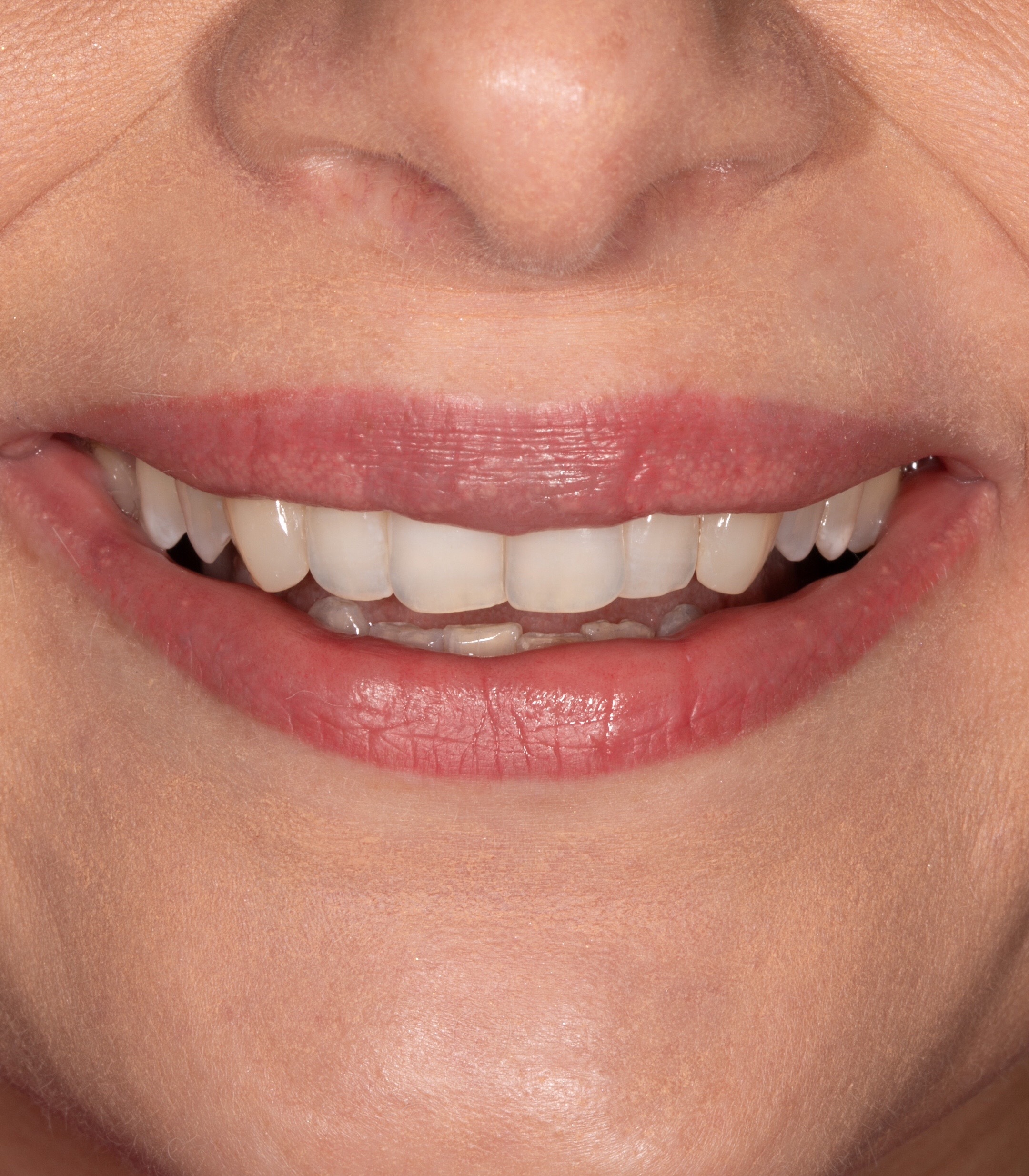 @Anna 🦷 dentystka