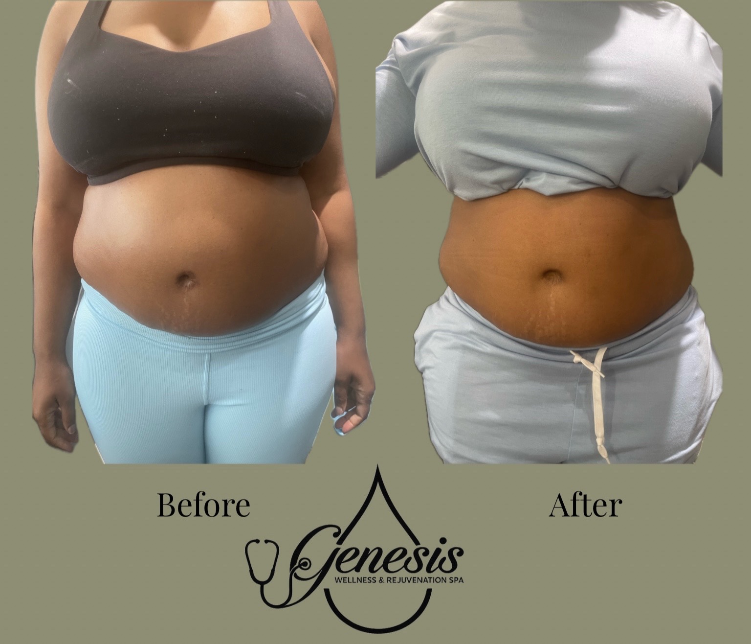 @Genesis Spa