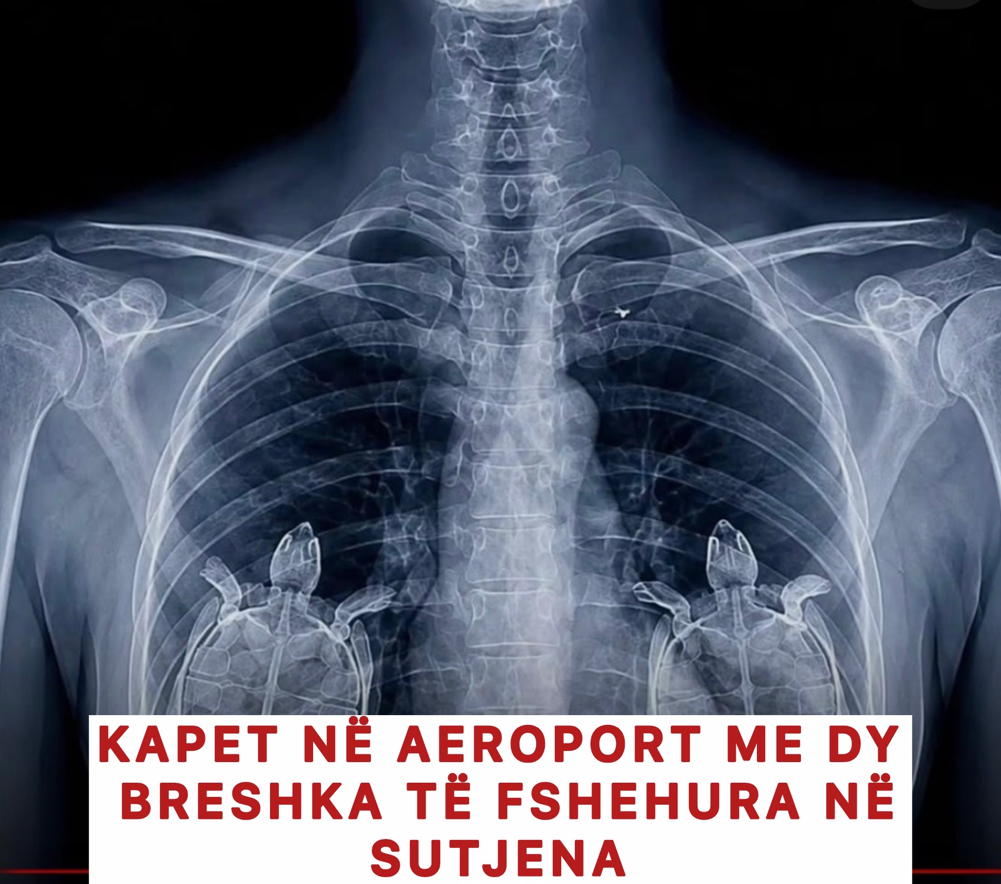 @NjuJorkezët
