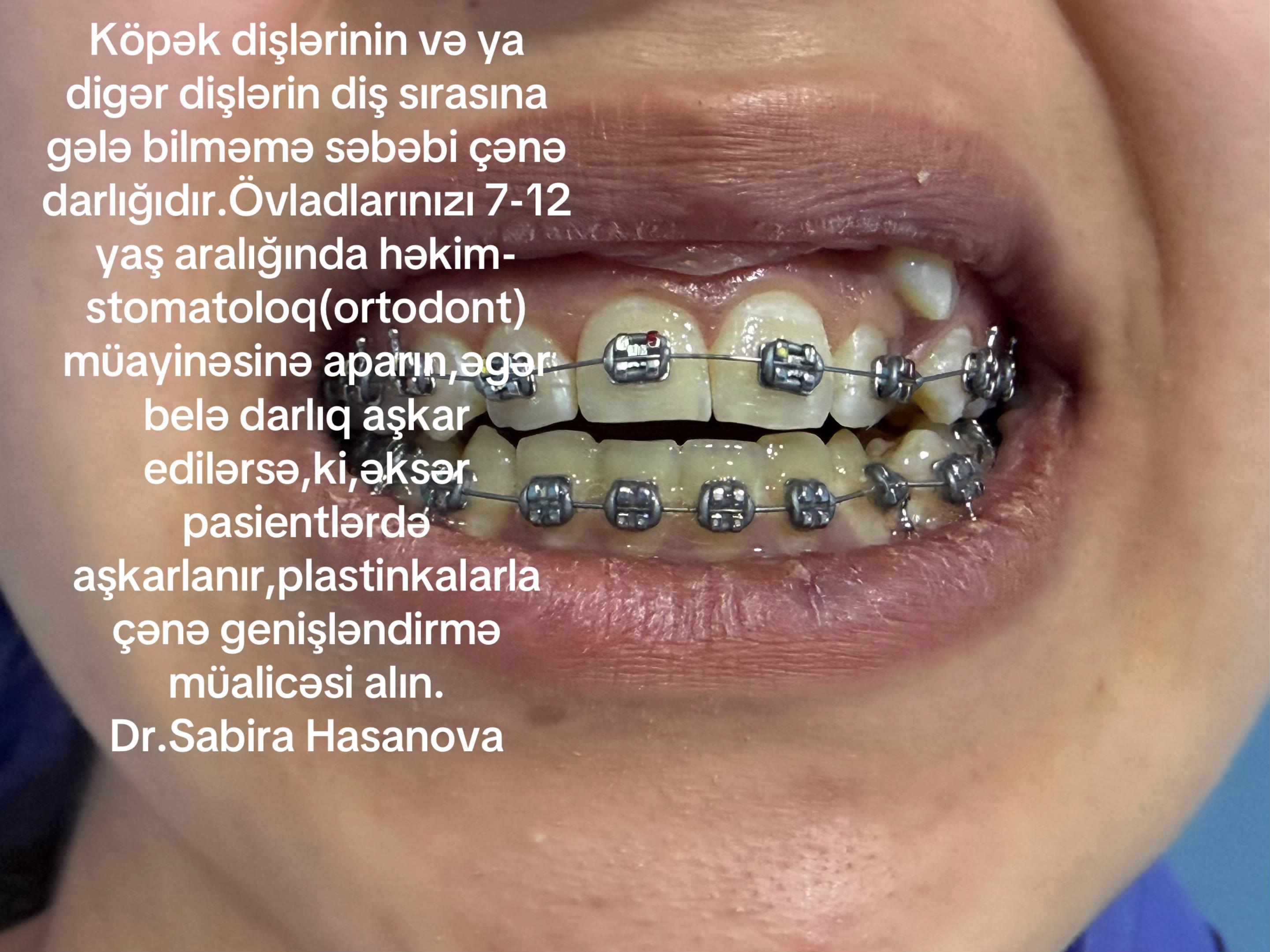 @ortodont Sabira Hasanova