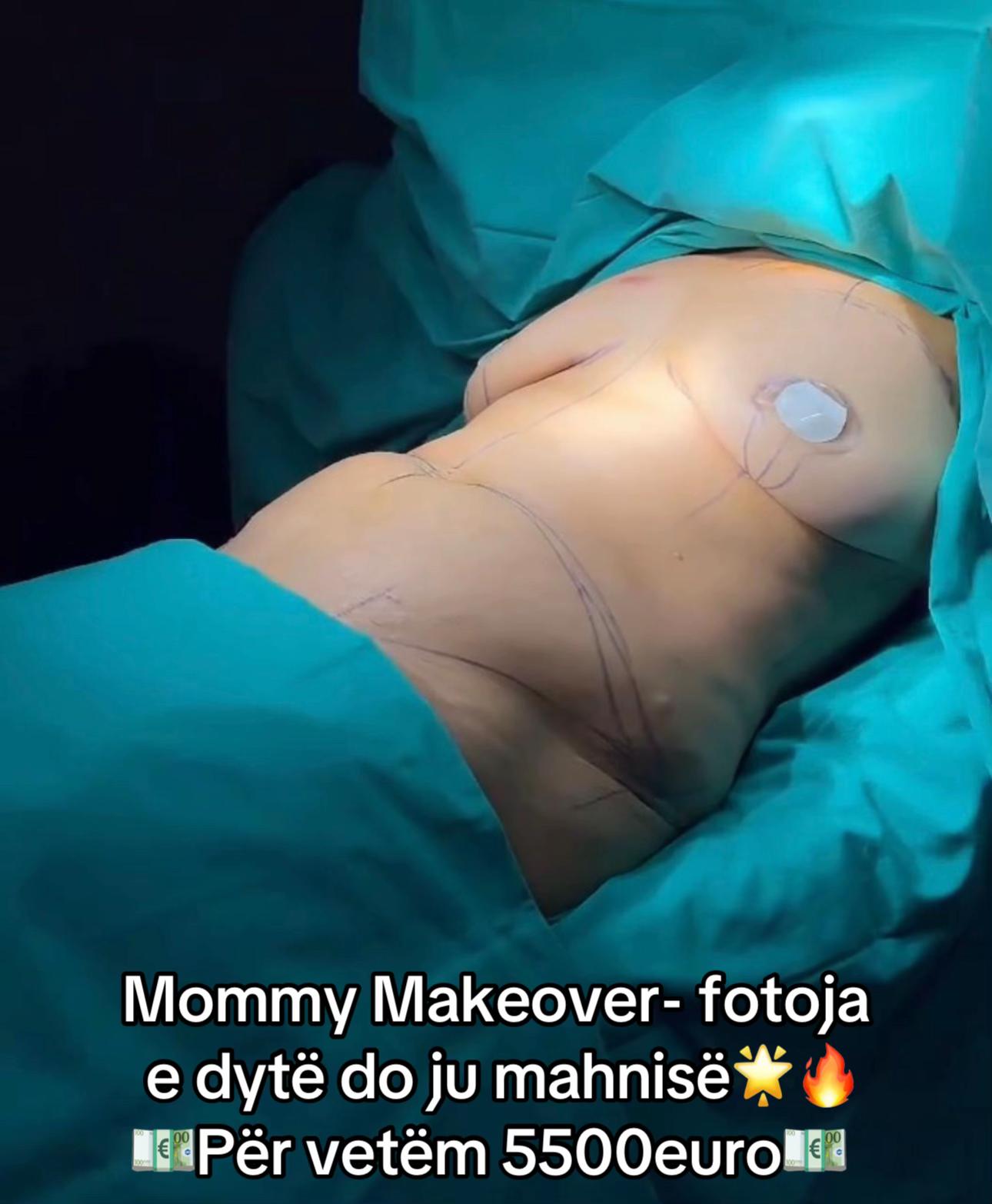 @rinoplasticatirana