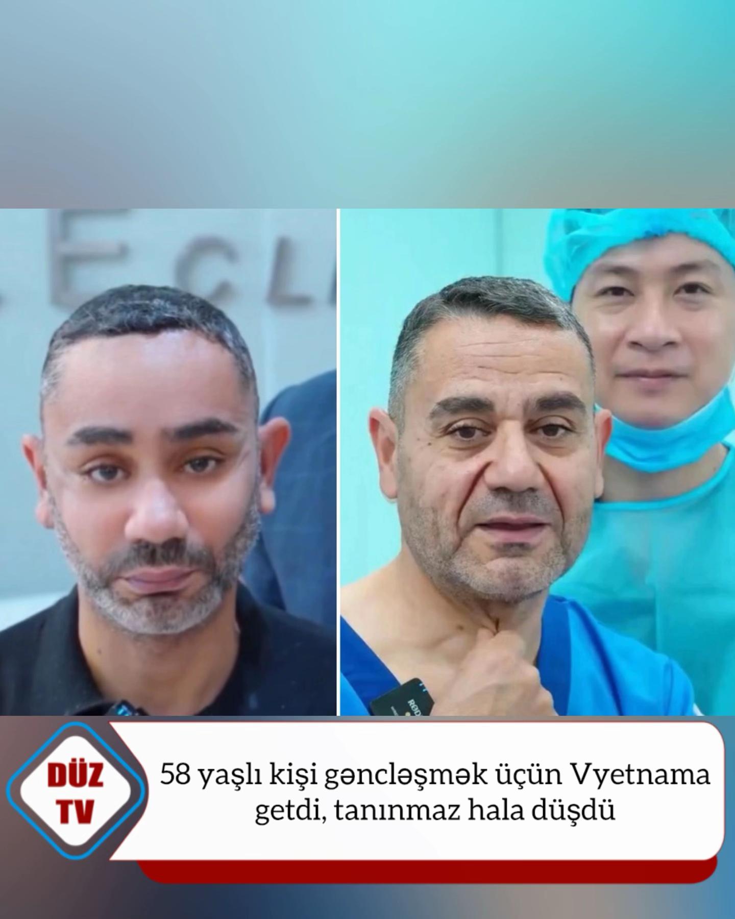 @Duz_tv_news
