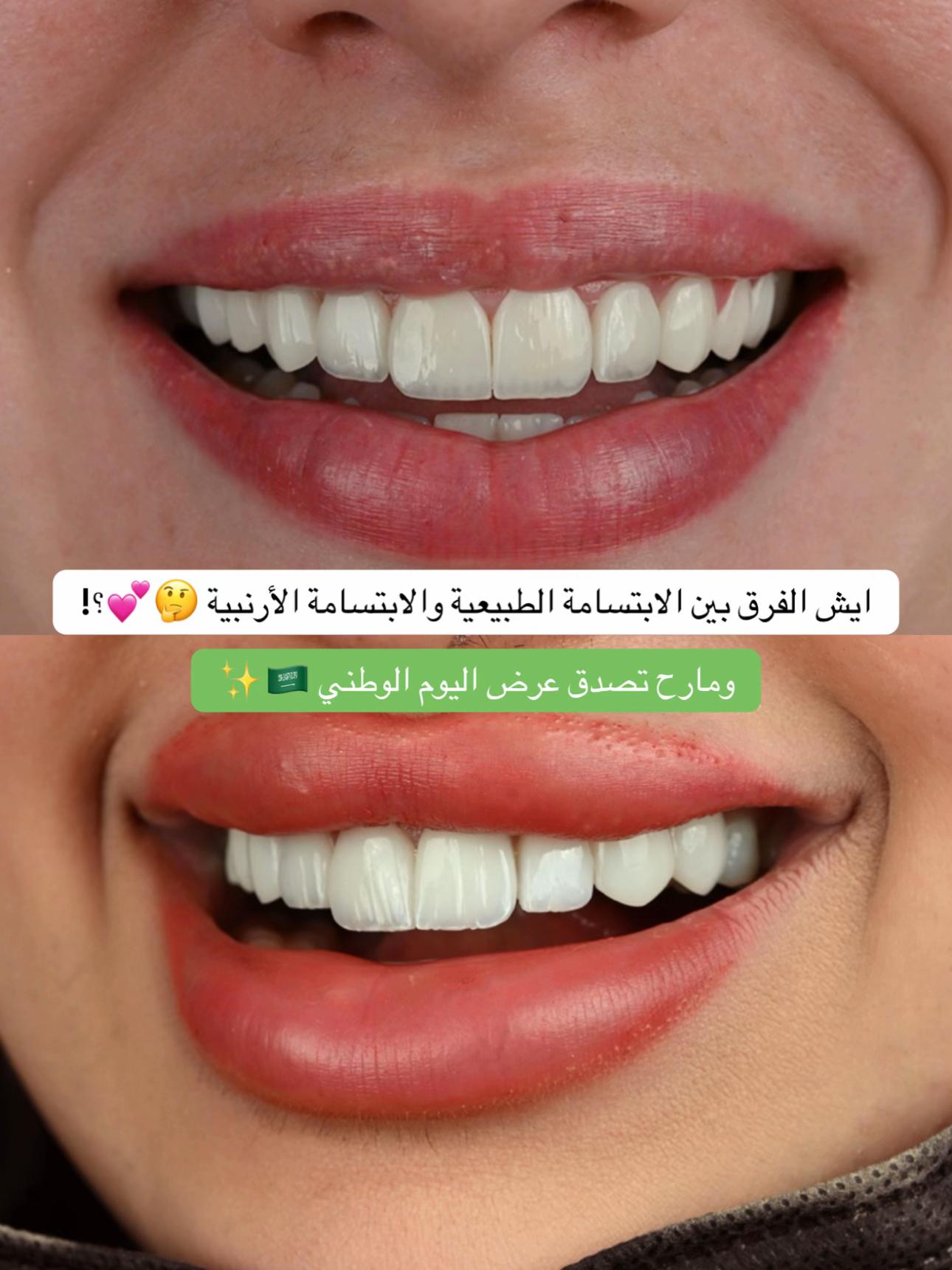 @عيادات البا للابتسامة