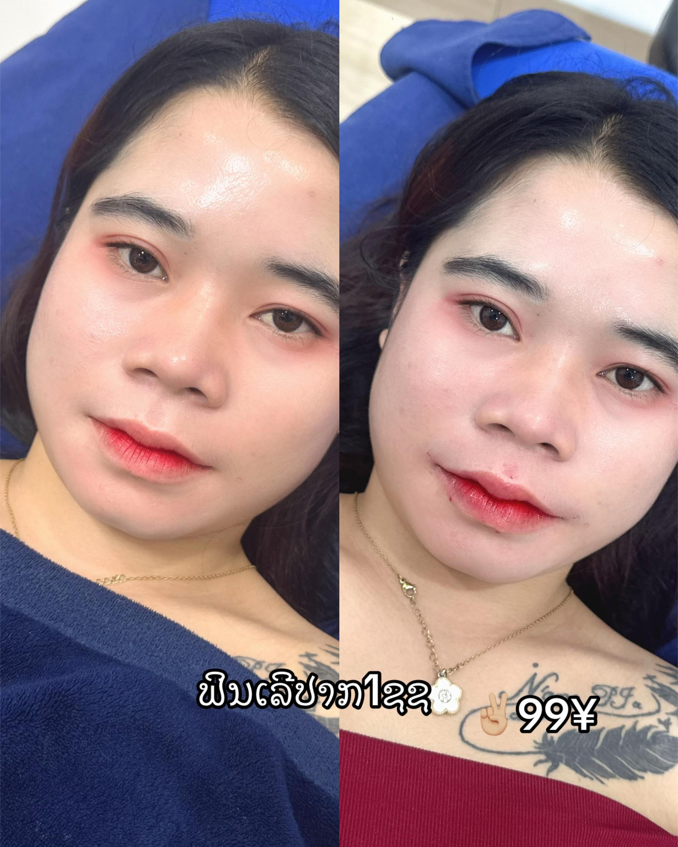 @ຫມໍນາ ສູນຄວາມງາມແຟຮຣີ້