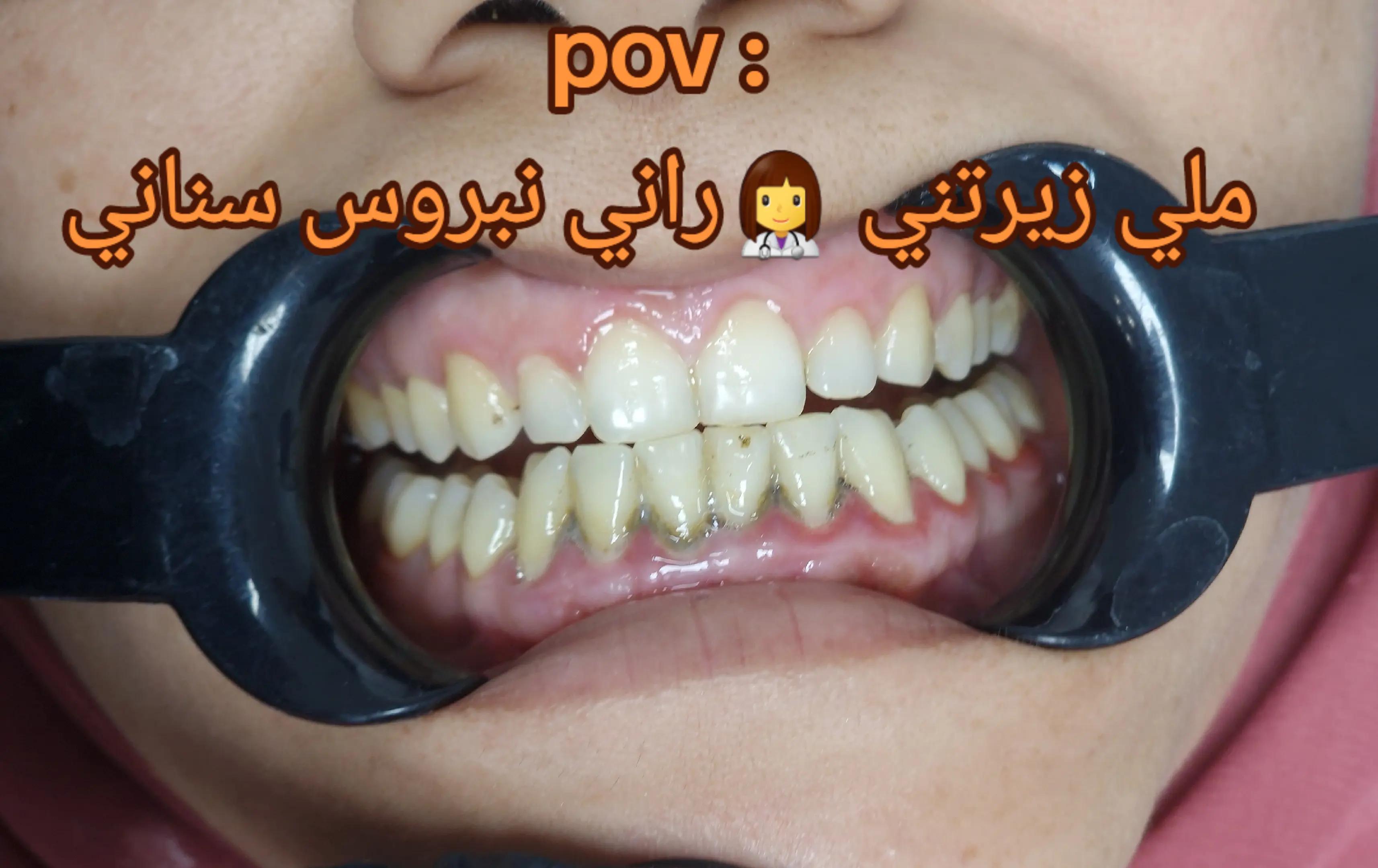 @Dr otmani. A 🦷🖤