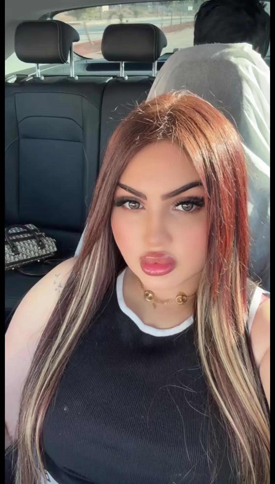 @Gatagatati