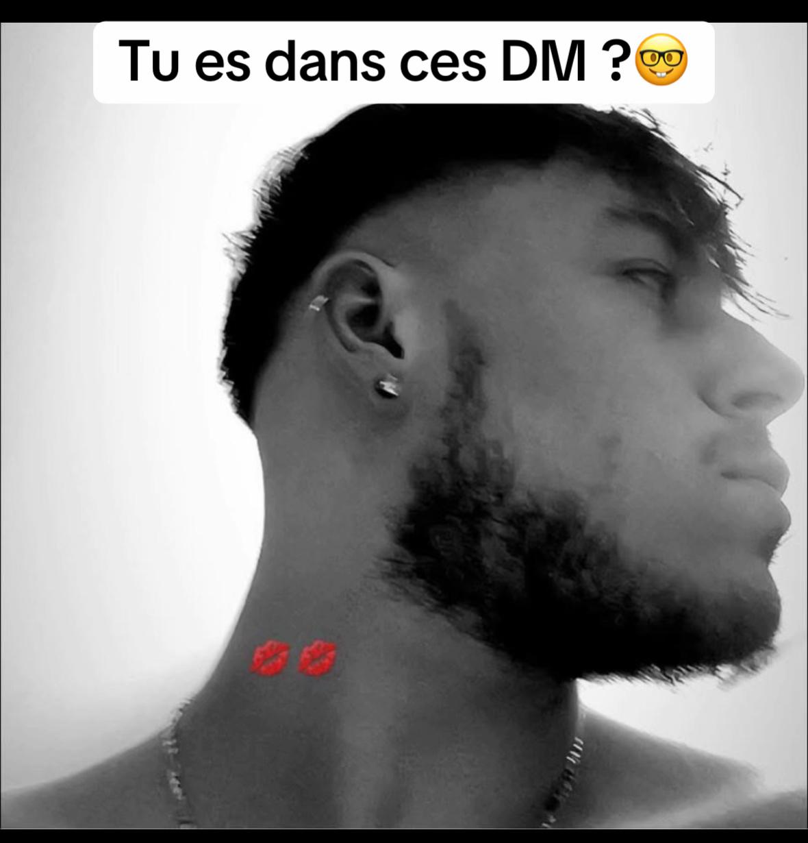 @hugo_volkz