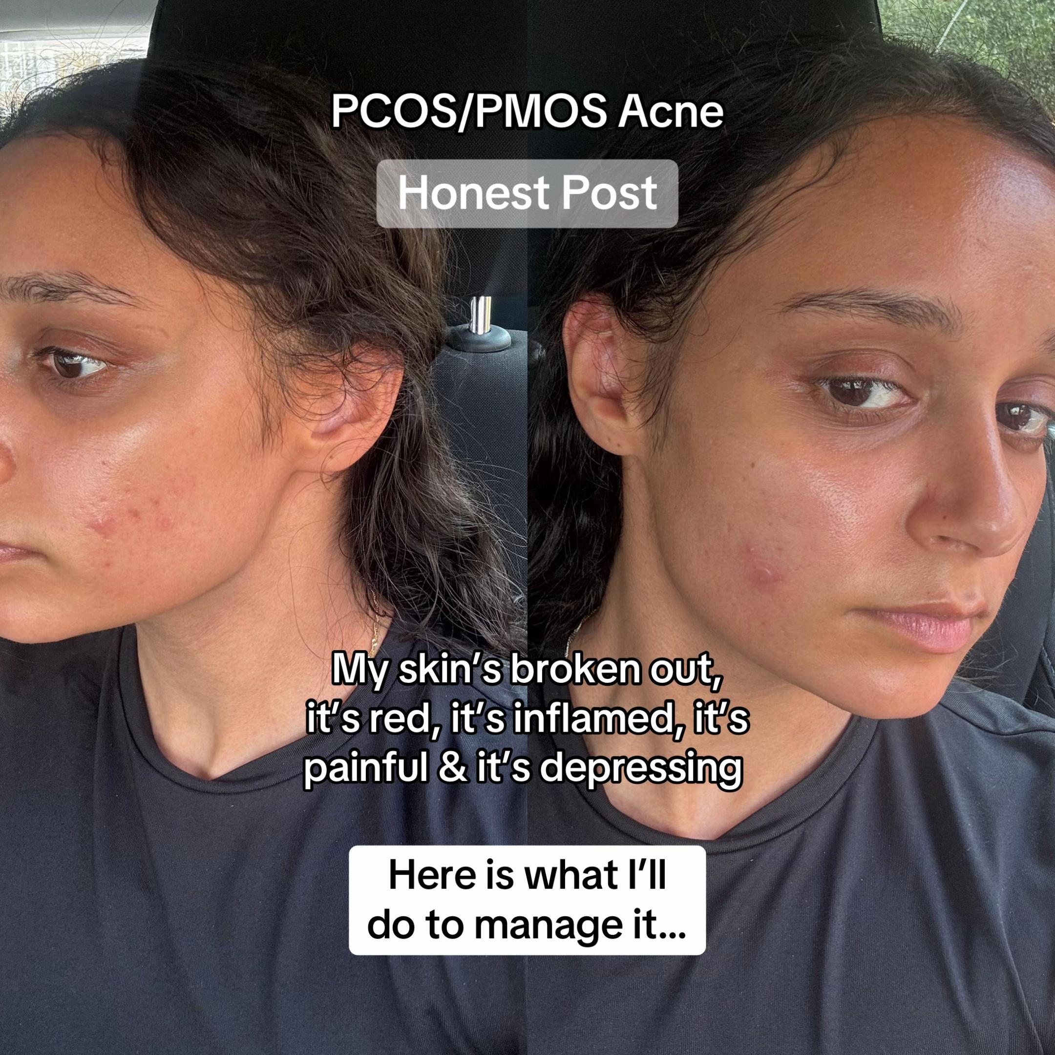 @Talvin | PCOS & Health Coach✨