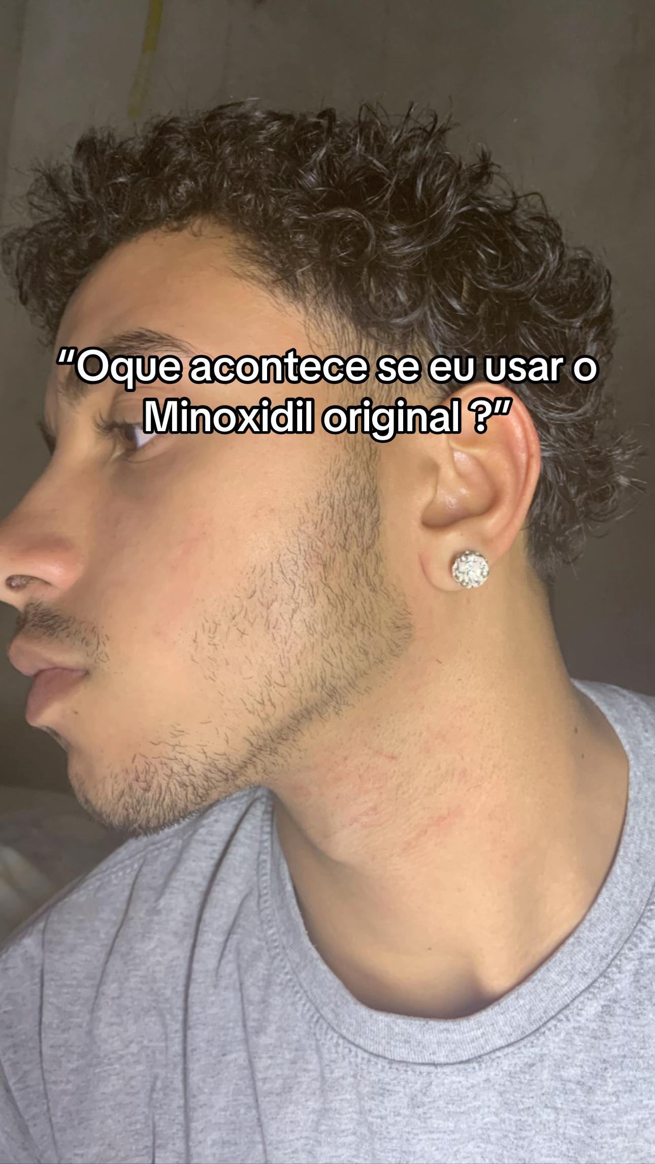 @Milo Pires