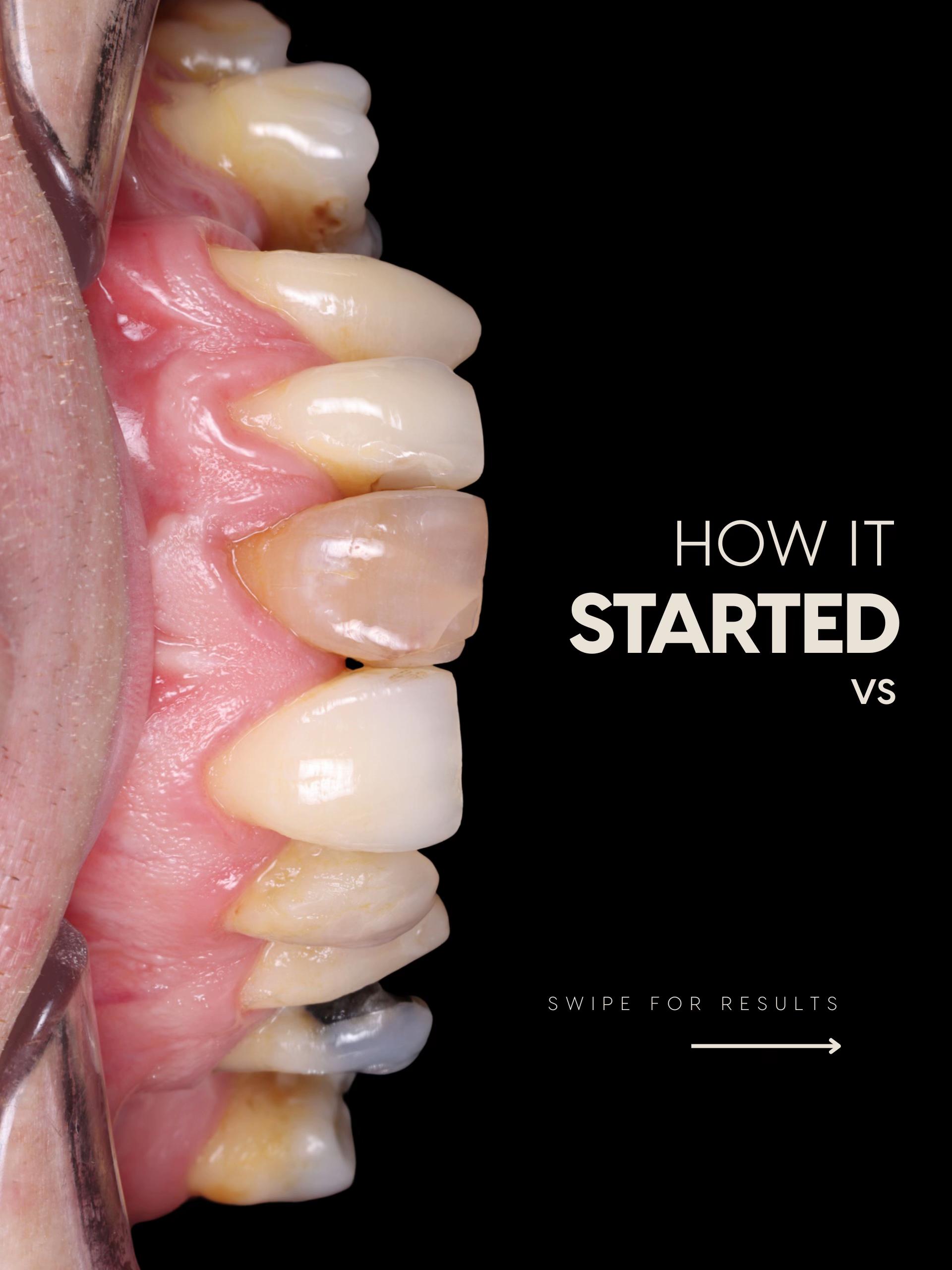 @Dentalexcellenceuk