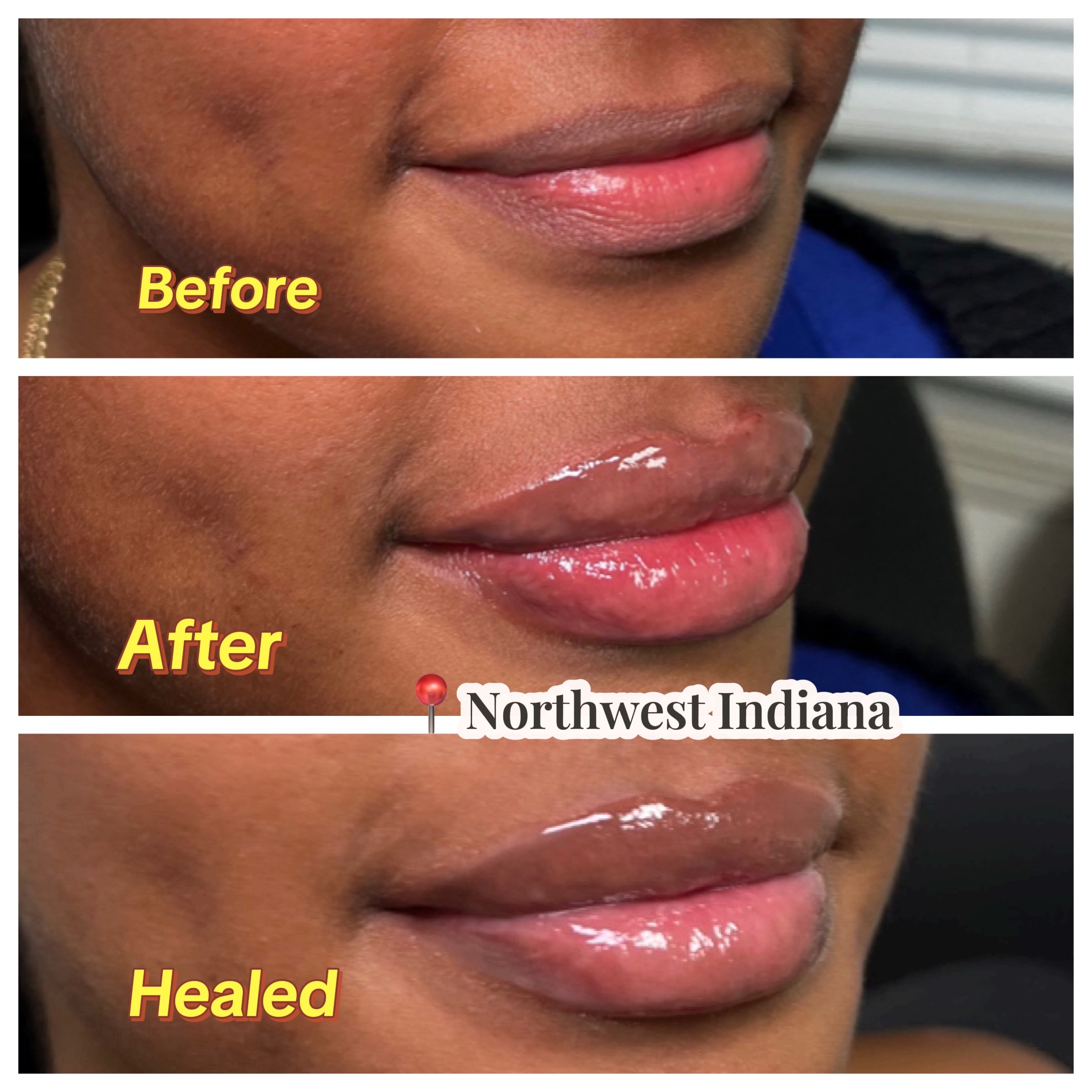 @Christy - NWI Aesthetic NP