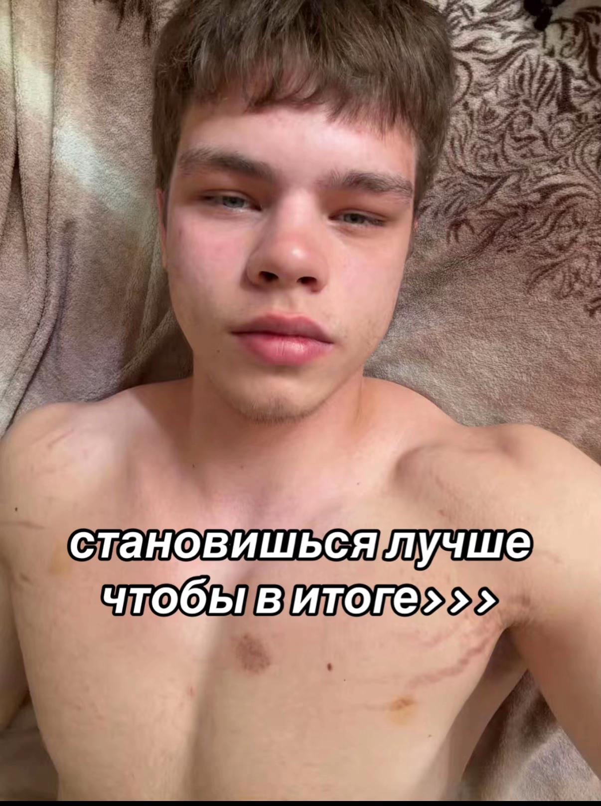 @Акира
