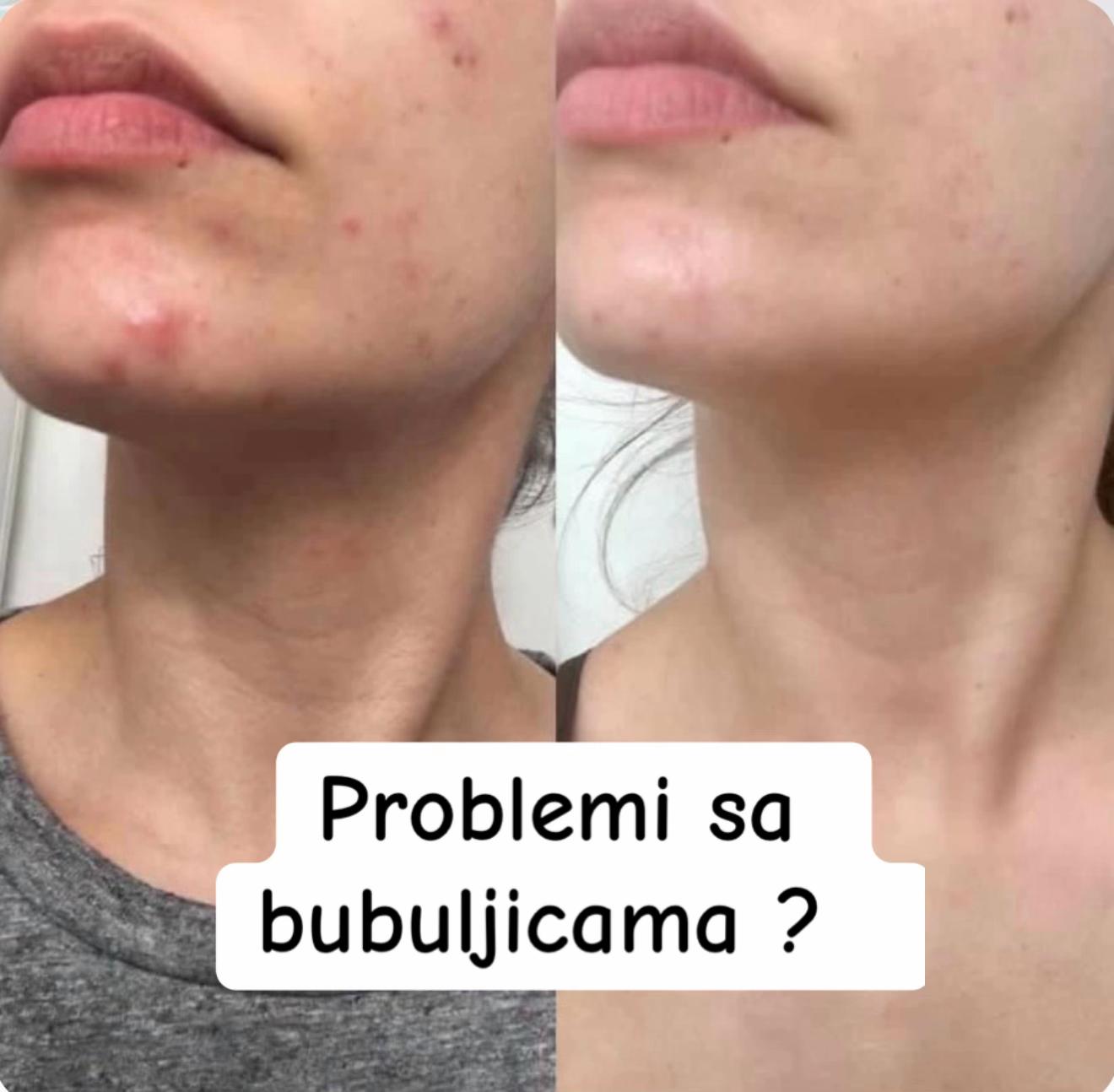 @ČistaKoža✨