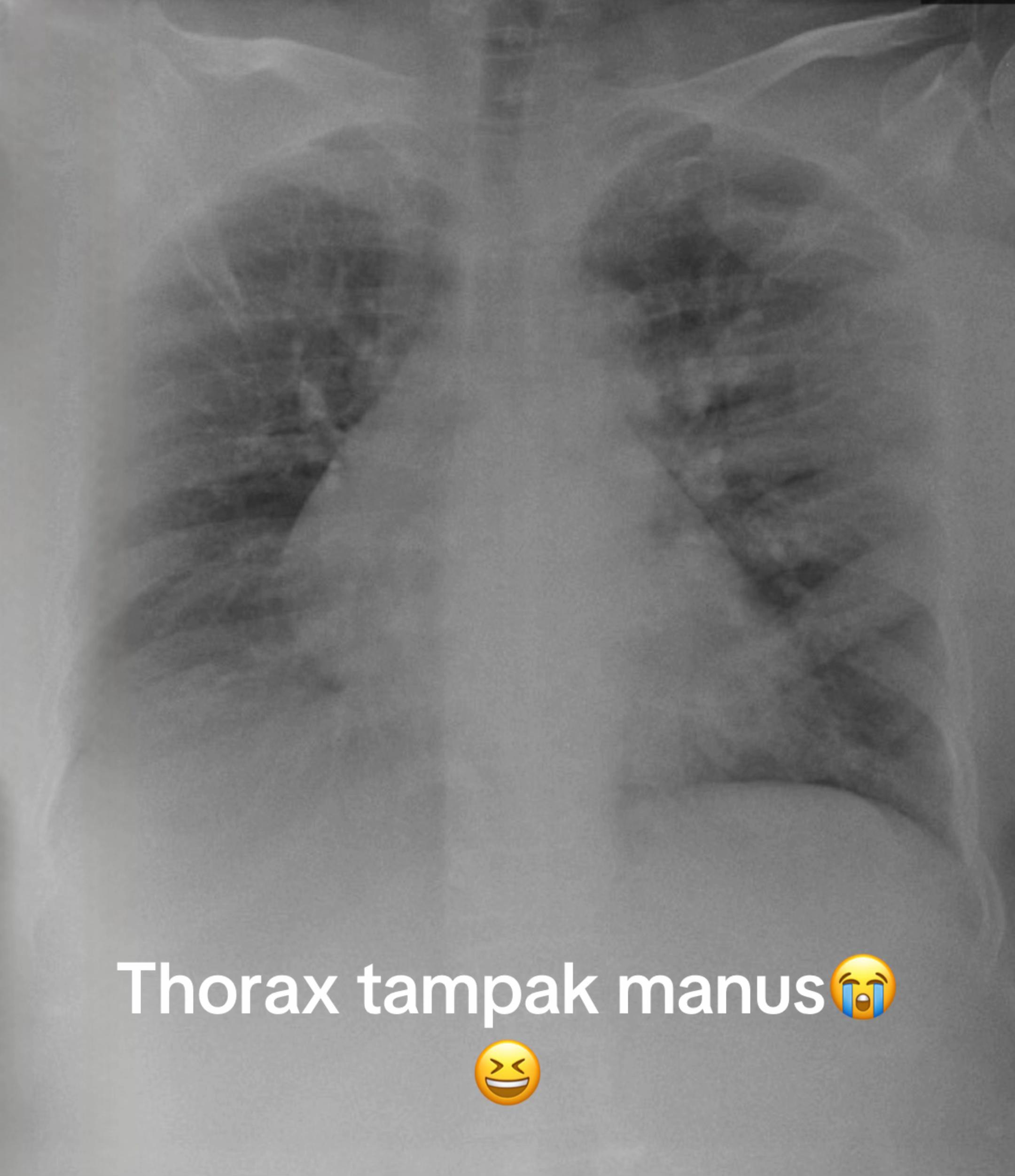 @Sobat Radiology