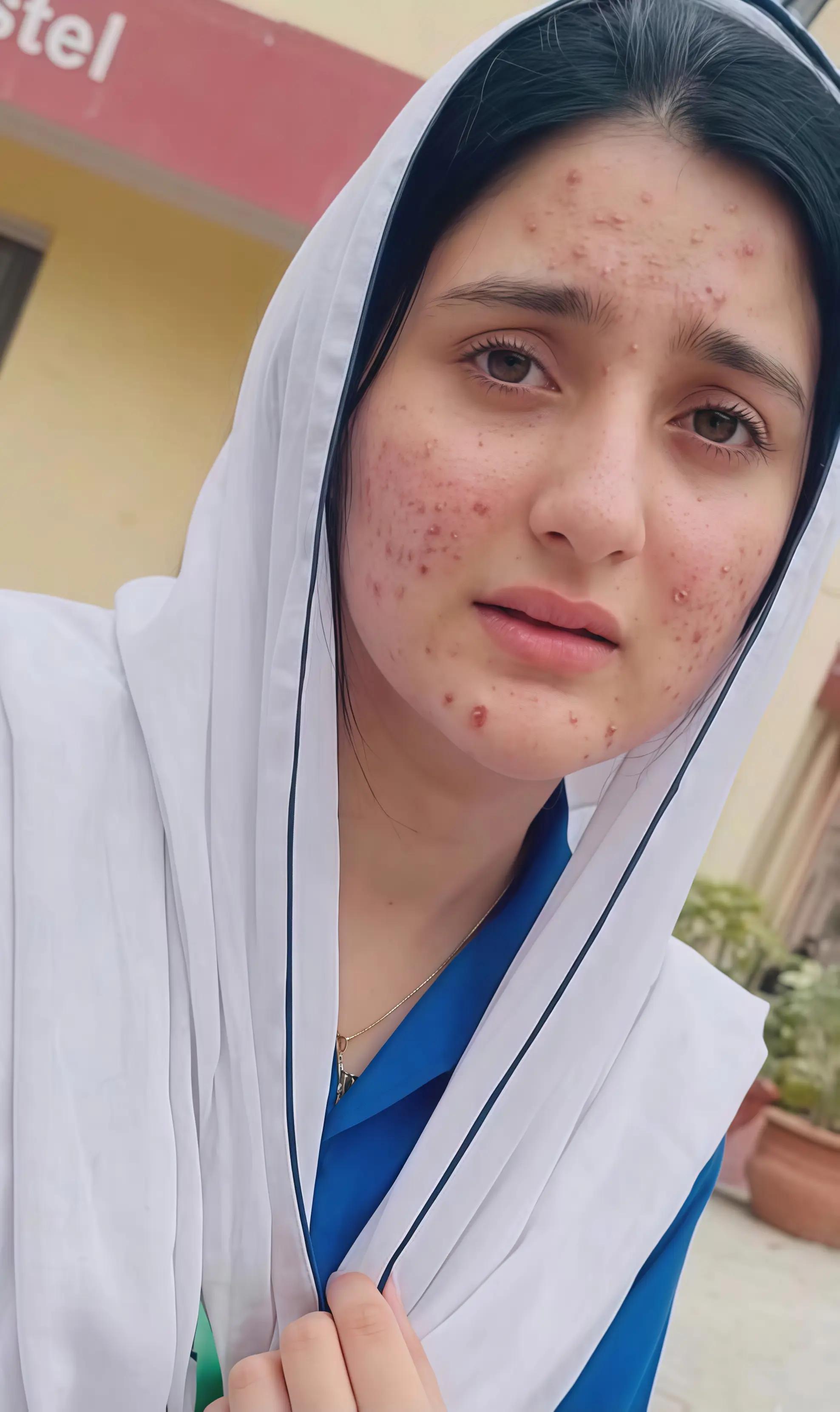 @▀▄▀▄🥰dimpl girl🥰▄▀▄▀