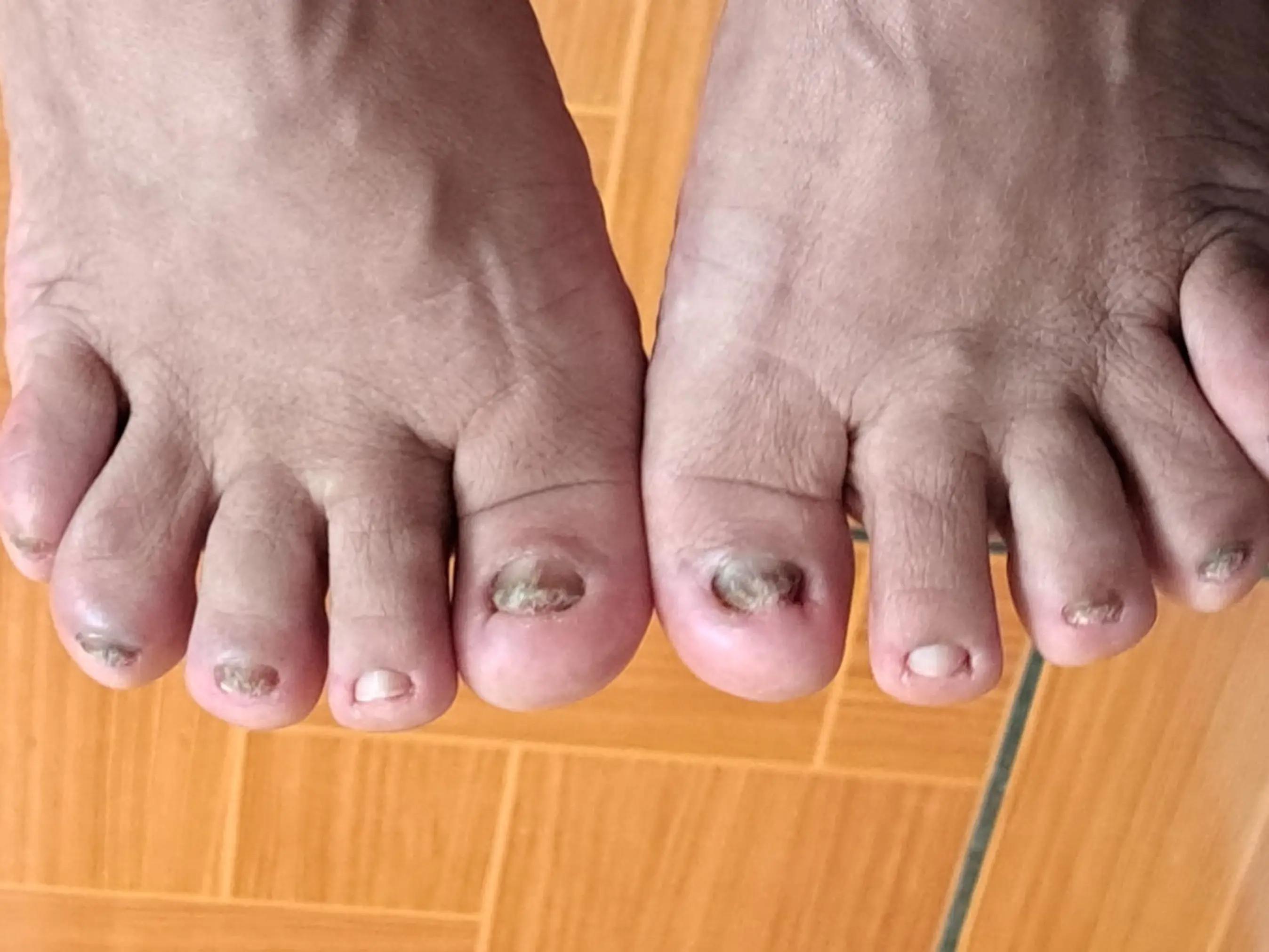 @Quiropodia HAPPY FOOT🇨🇷
