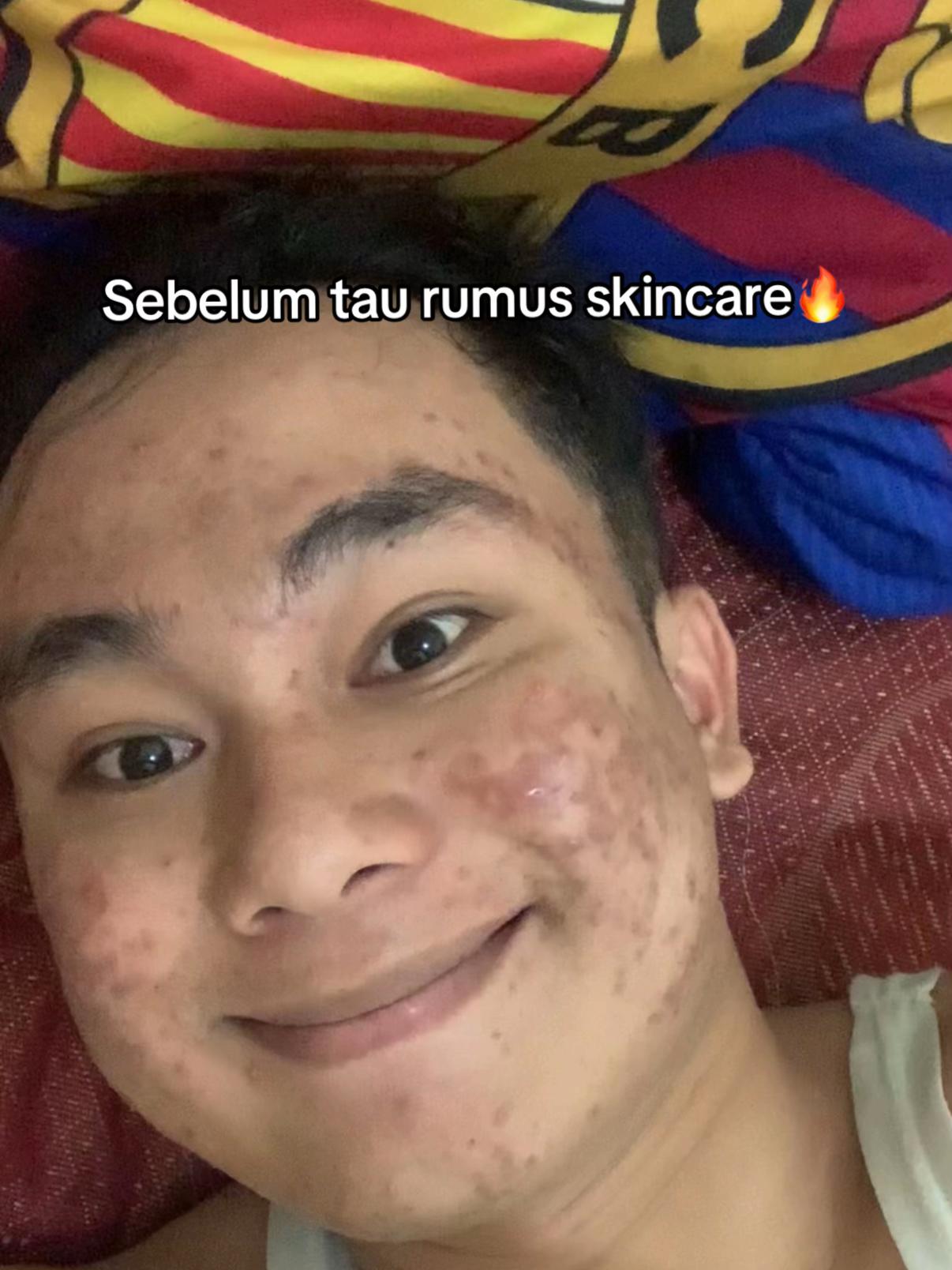 @Muekkk