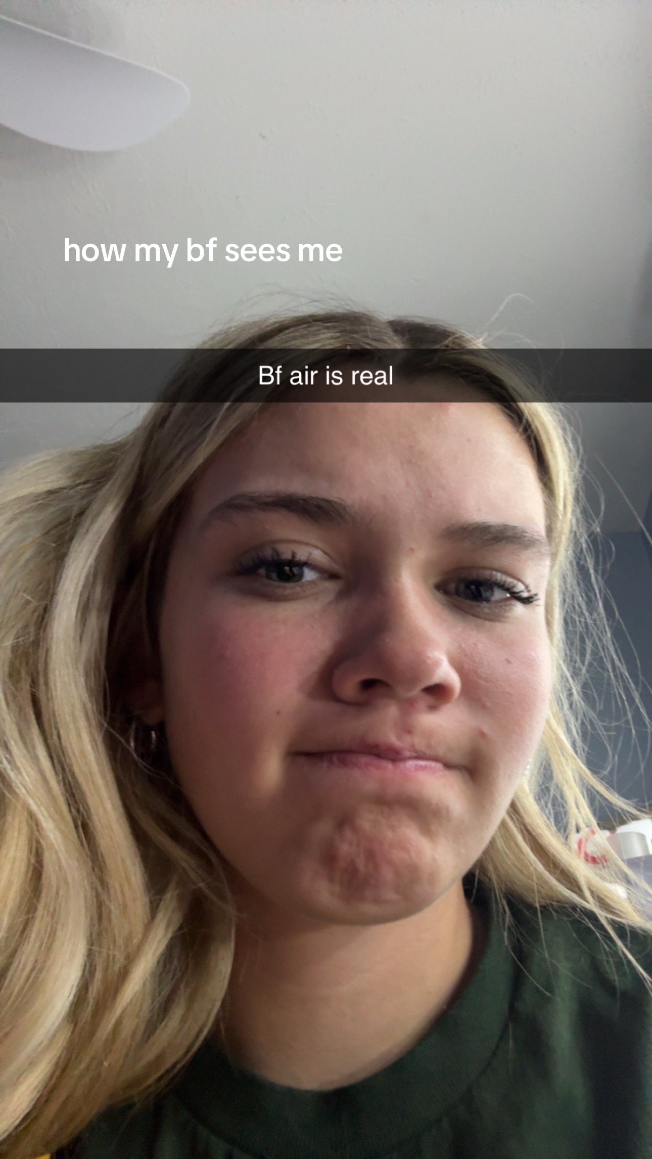 @User41