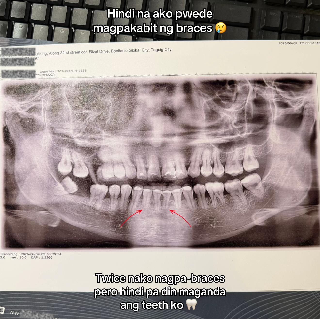 @DeejimonTV 🧿