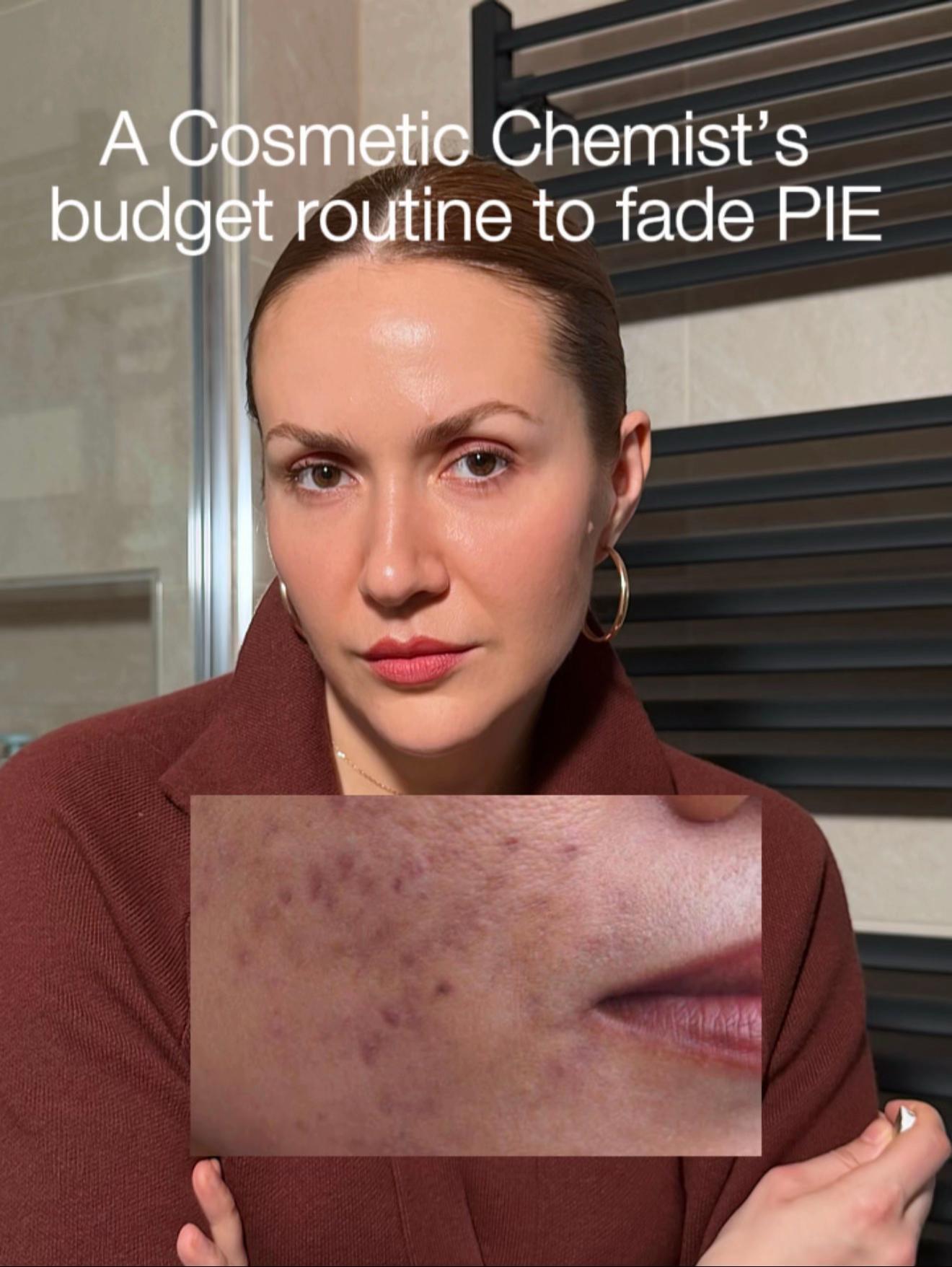 @Marina @4complexion