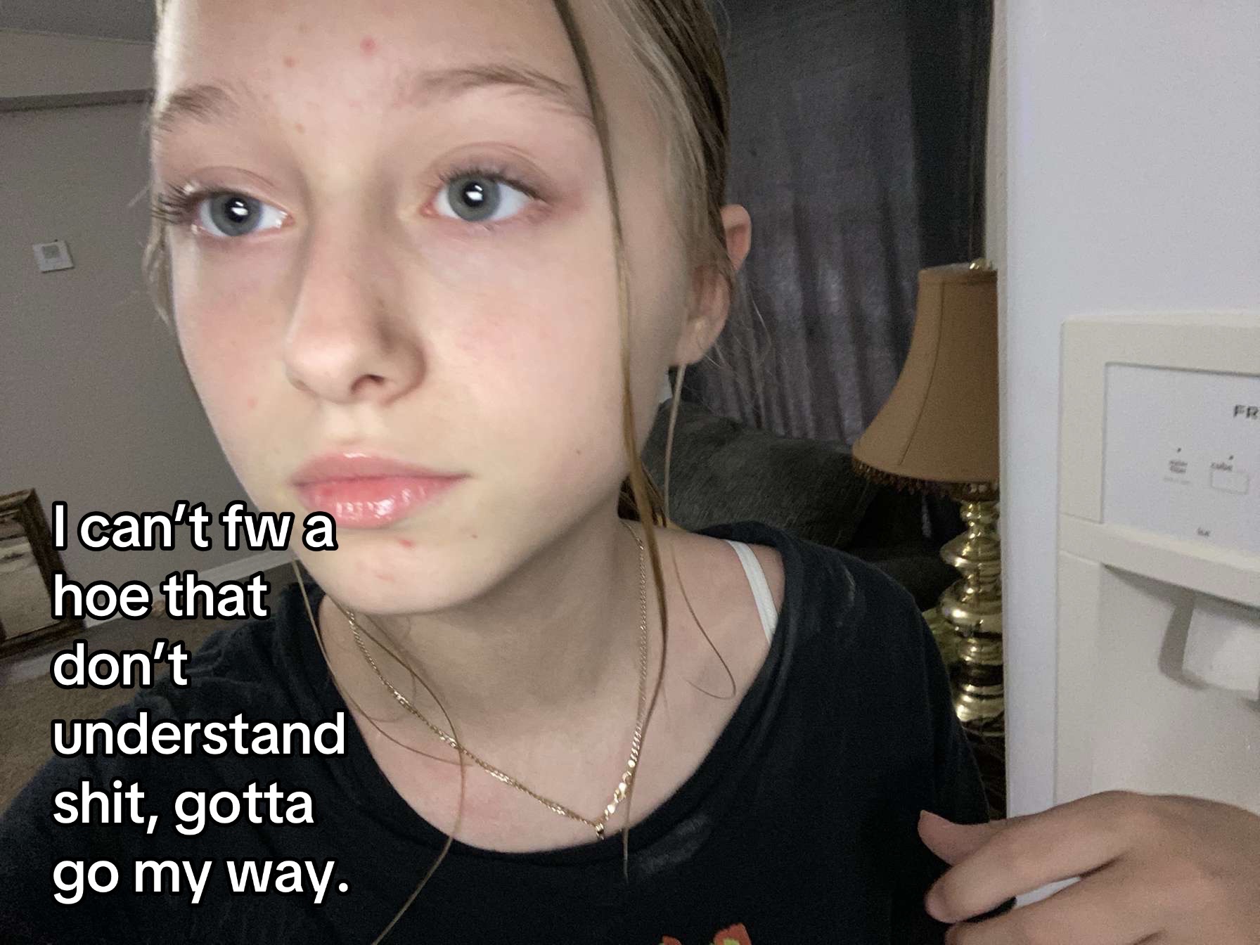 @𝘥𝘢𝘭𝘵𝘺𝘯𝘯𝘭𝘰𝘷𝘦𝘻𝘺𝘰𝘶