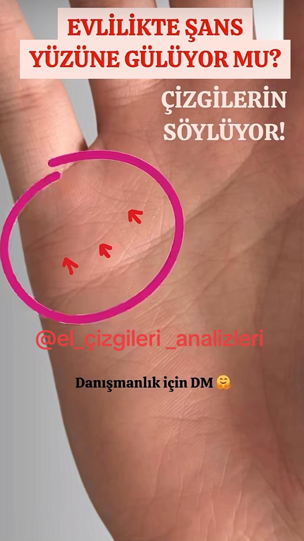 @Fizyomonist .Berk