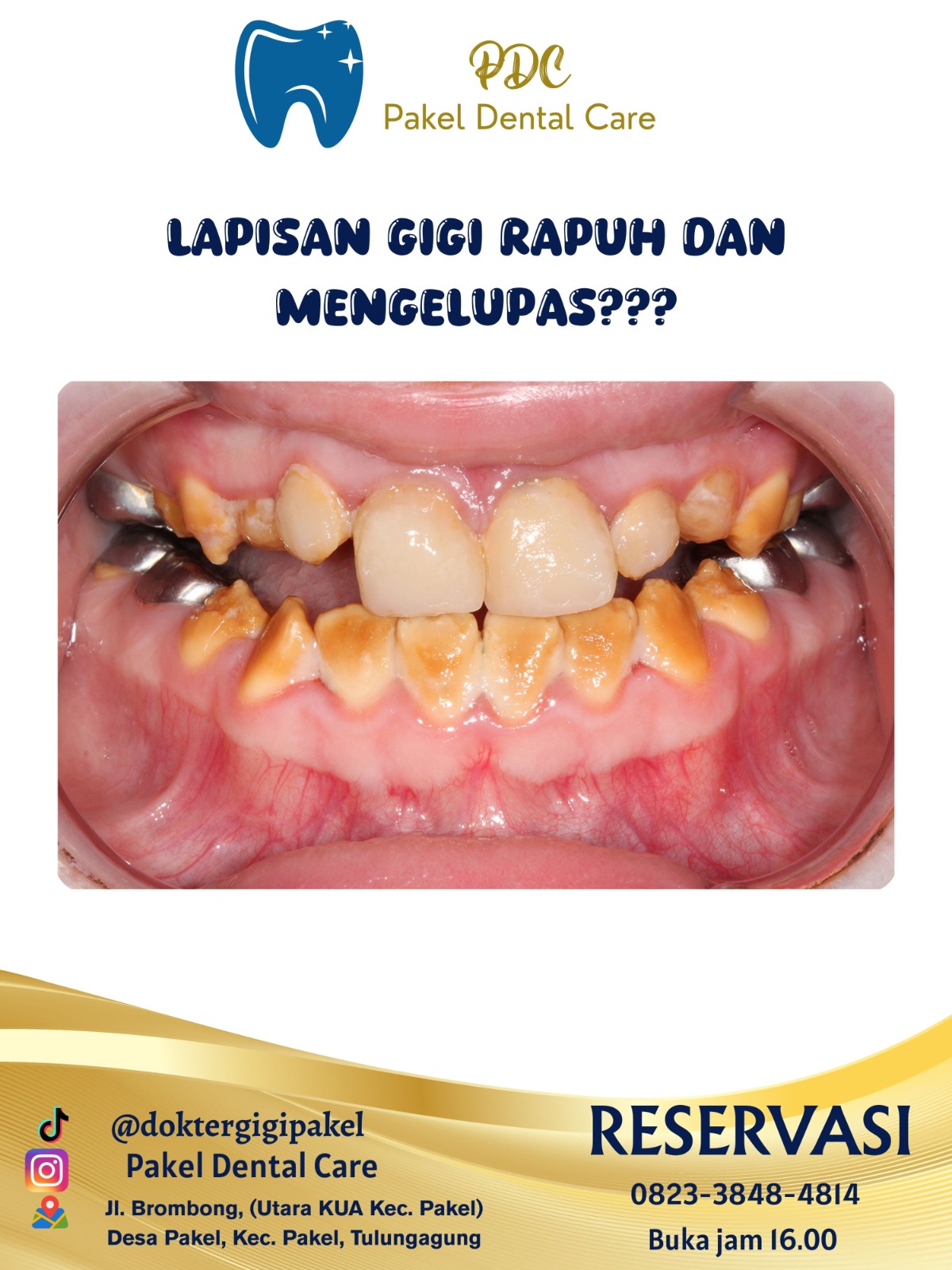 @Pakeldentalcare