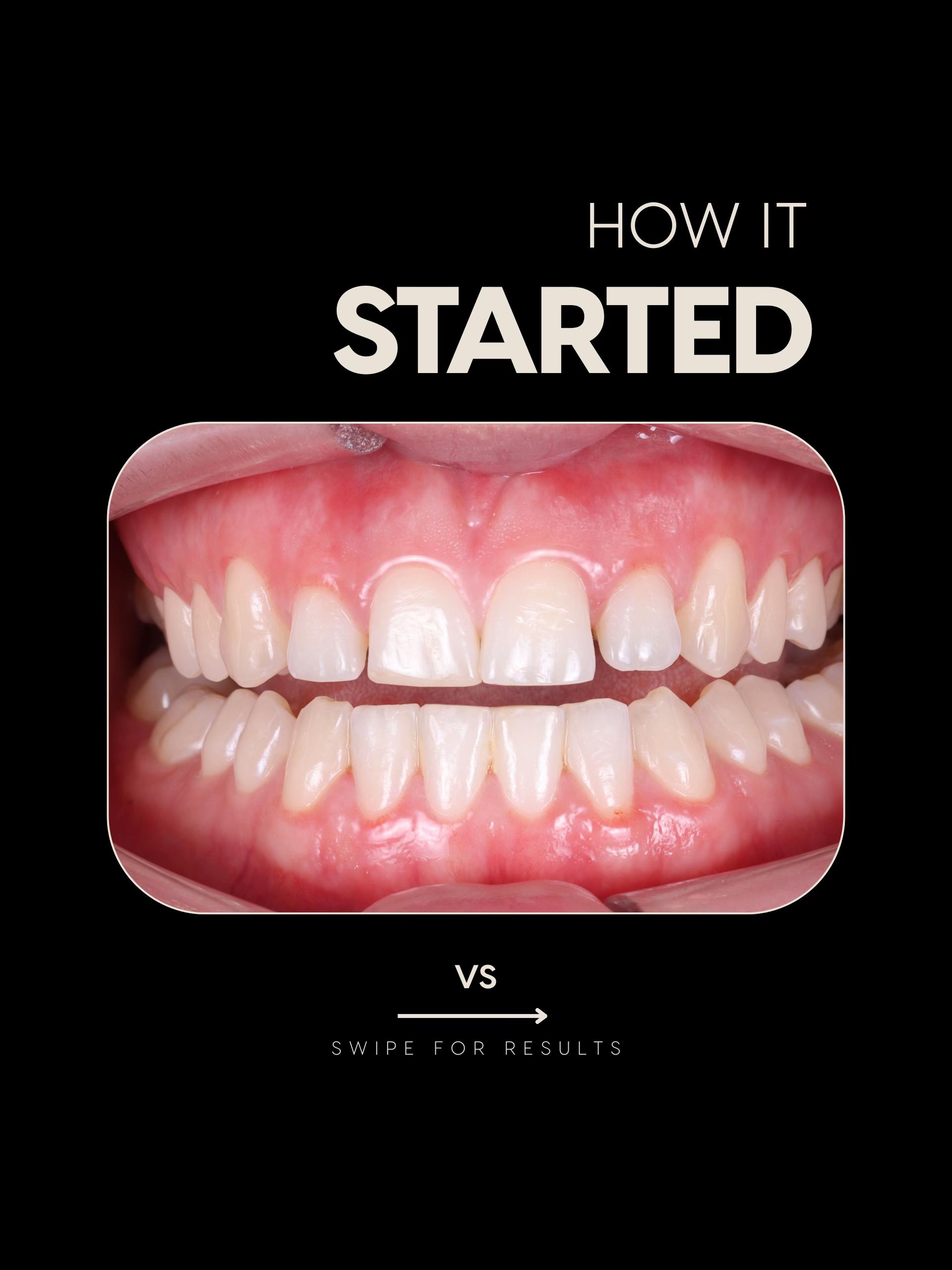 @Dentalexcellenceuk