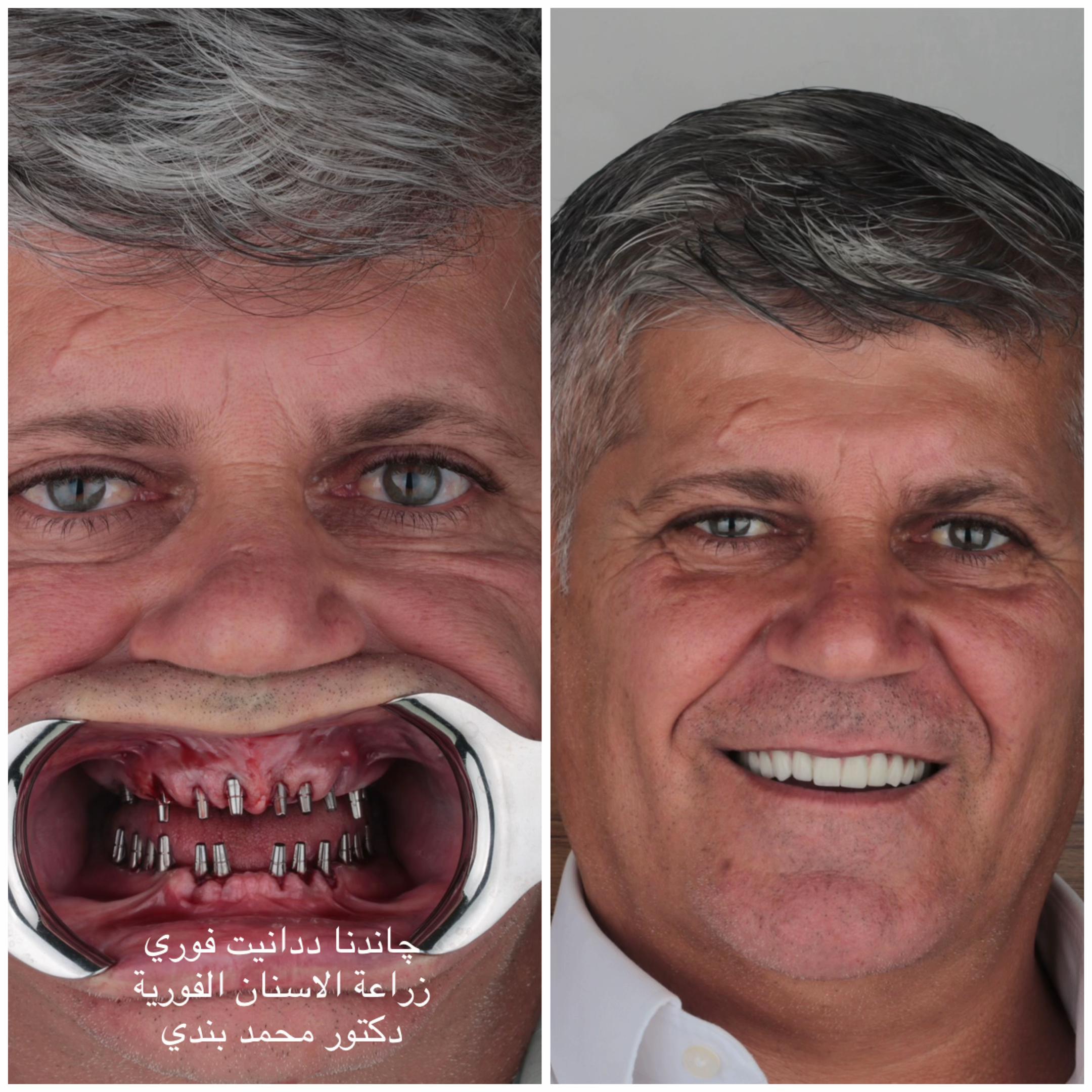 @Dr.Mohammed.Bandi