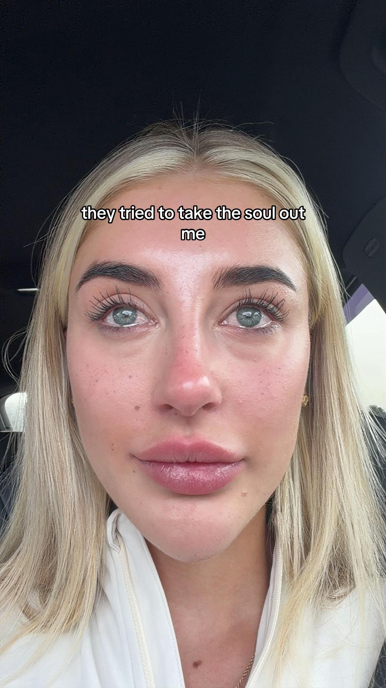 @em