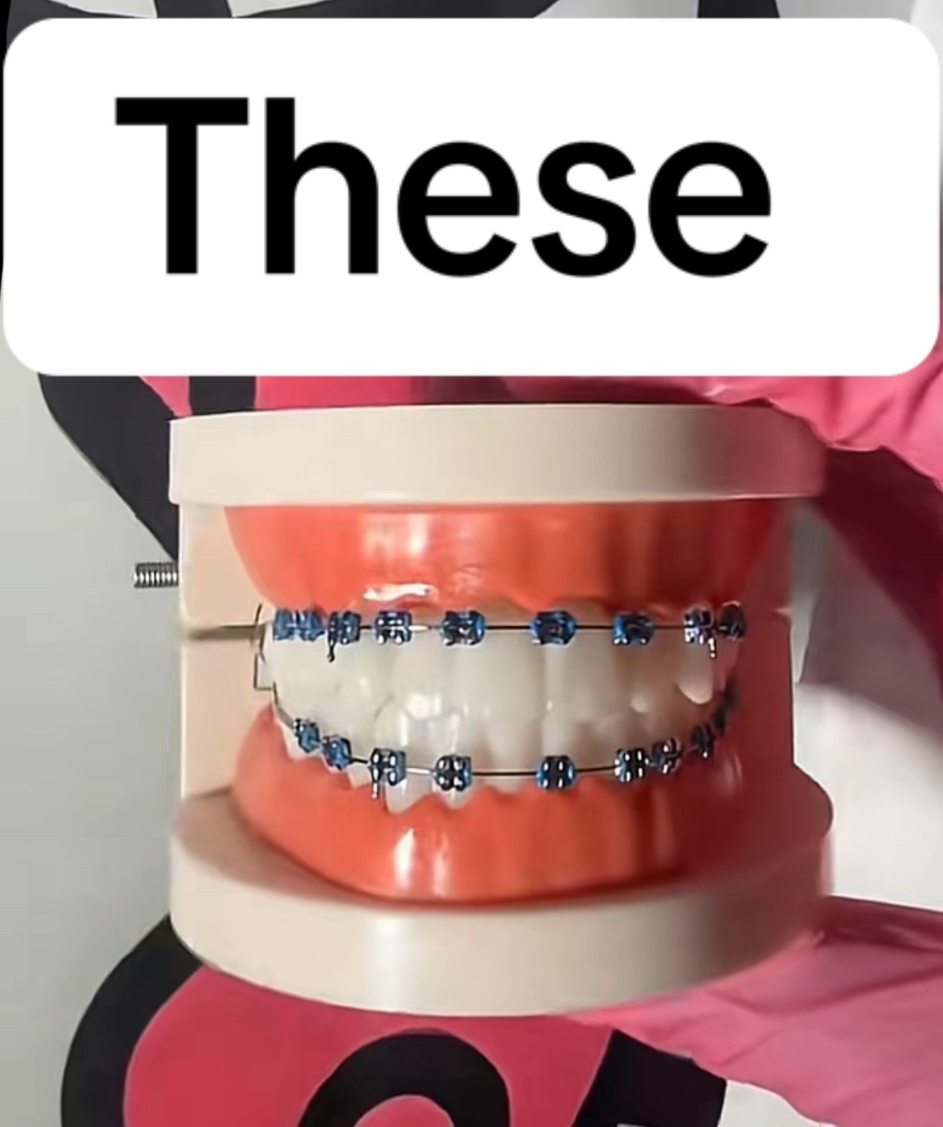 @Princessbracesplug🫶🏽🫆