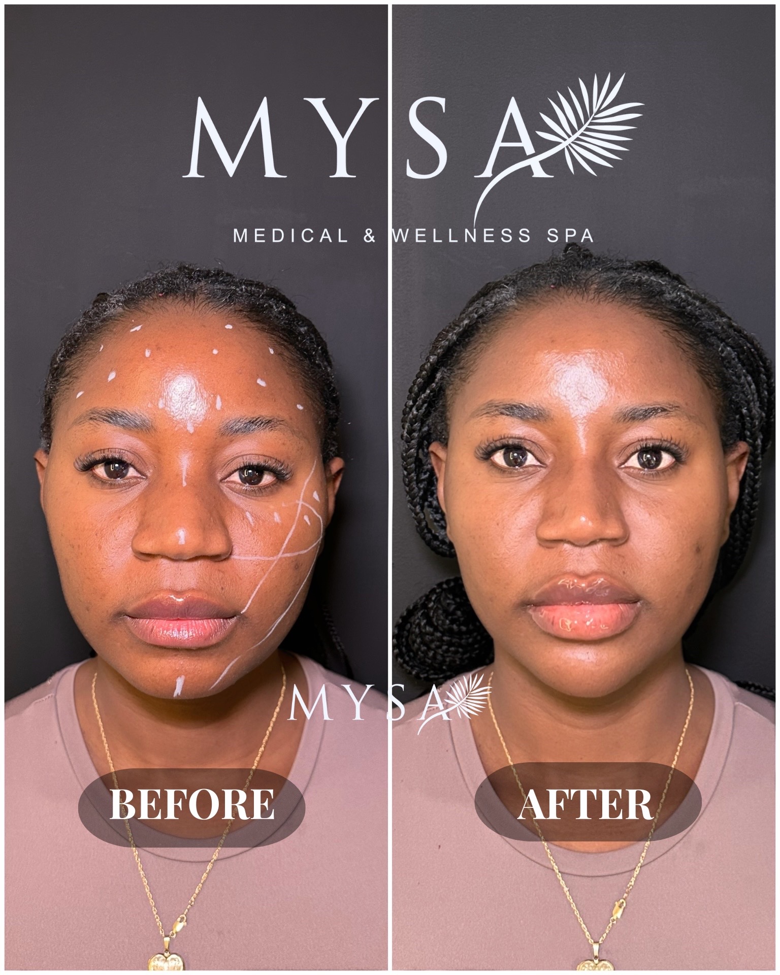 @Mysa Medical & Wellness Spa