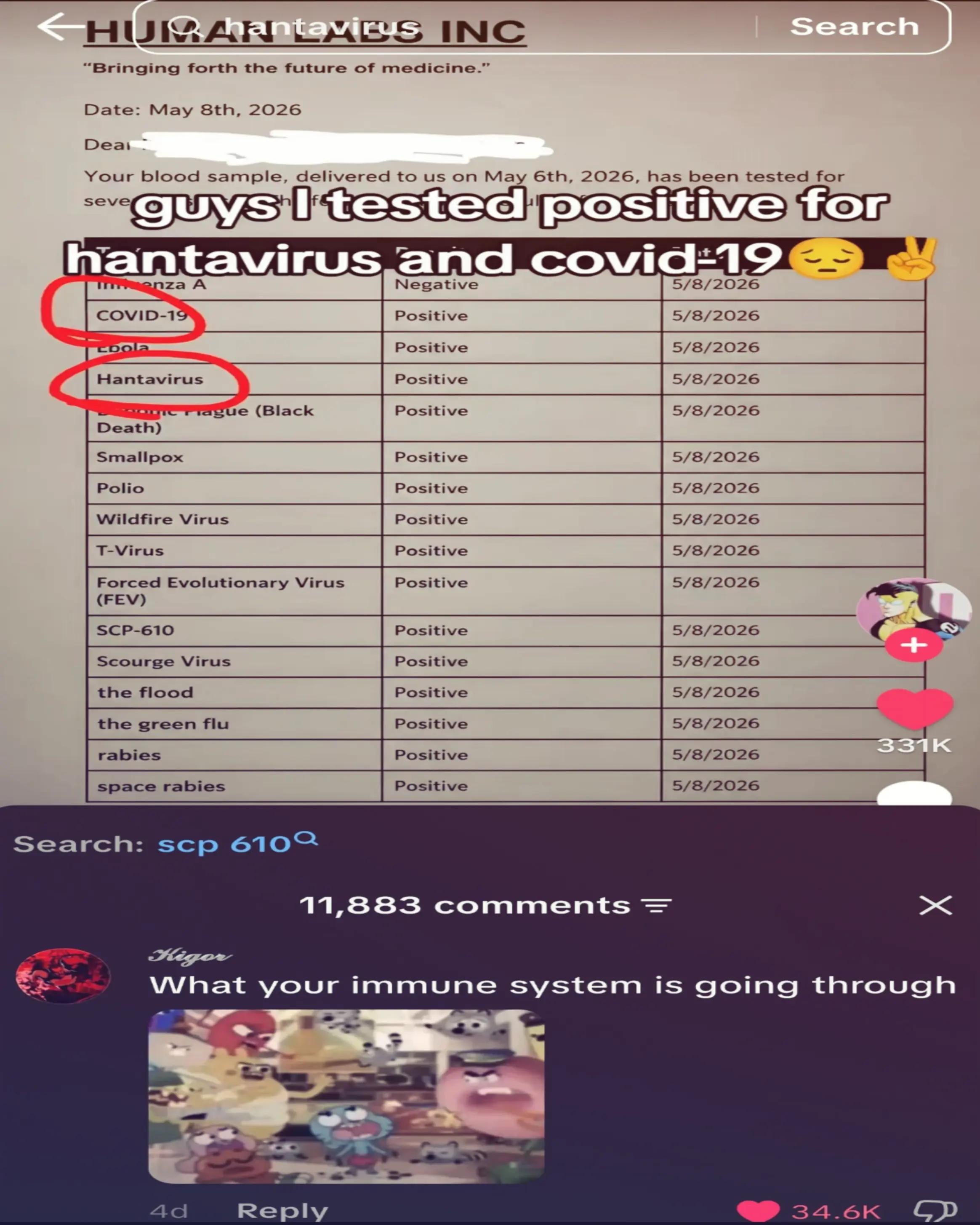 @Bro💀