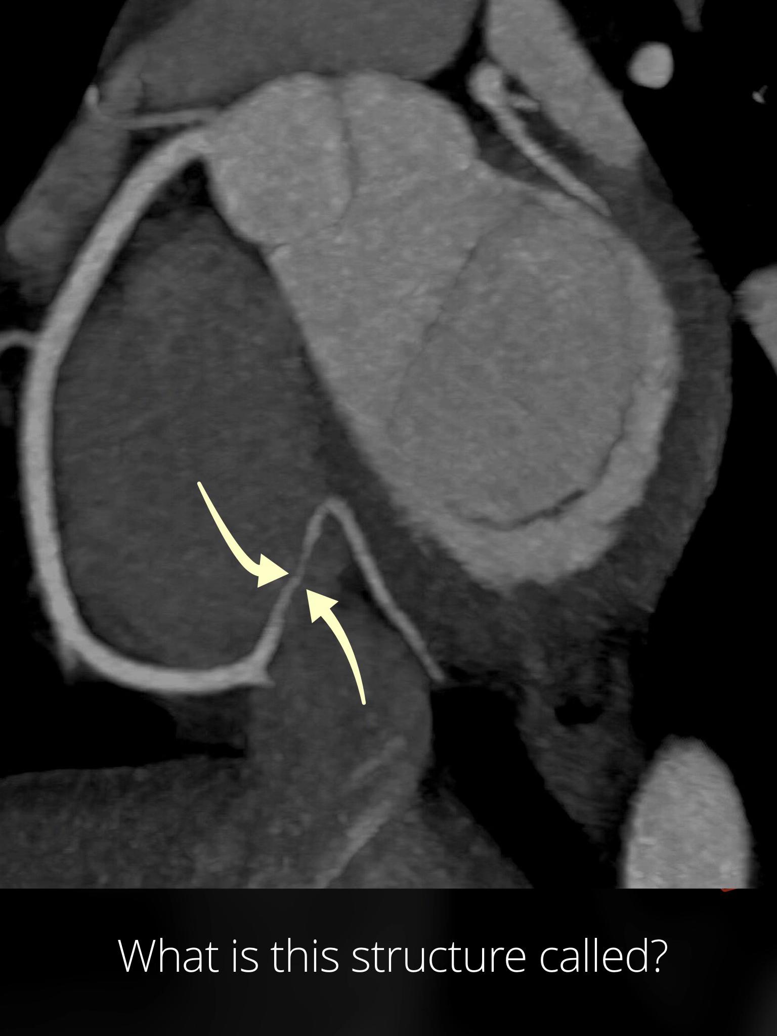 @The Radiologist