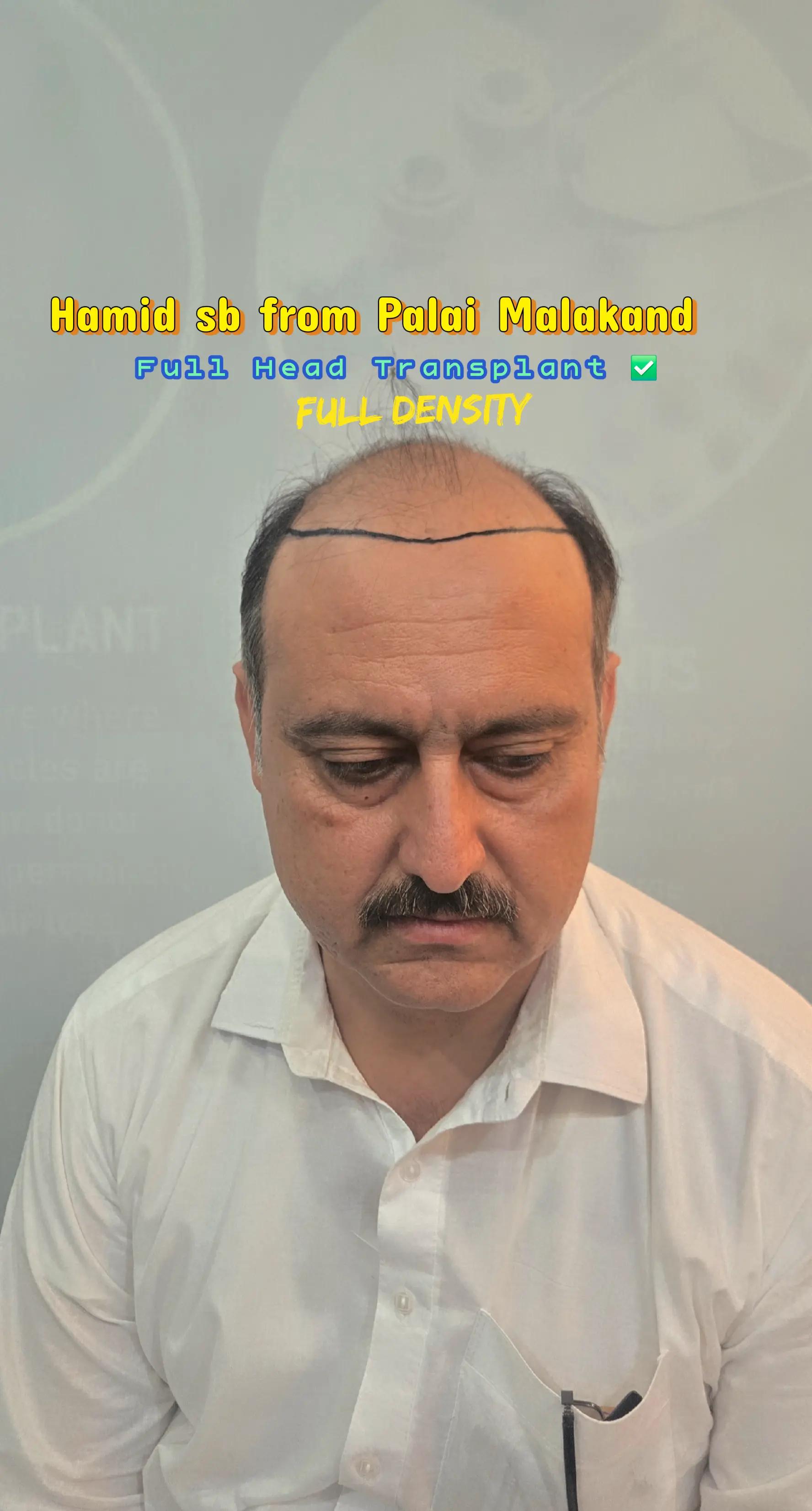 @Dr Asad shalman