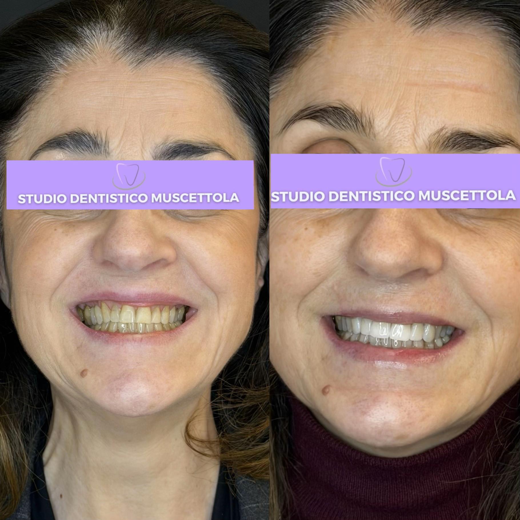 @Dott.Marta | Estetica Dentale