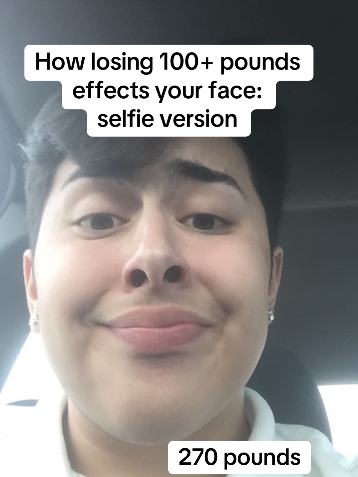 @Jonny Valdez