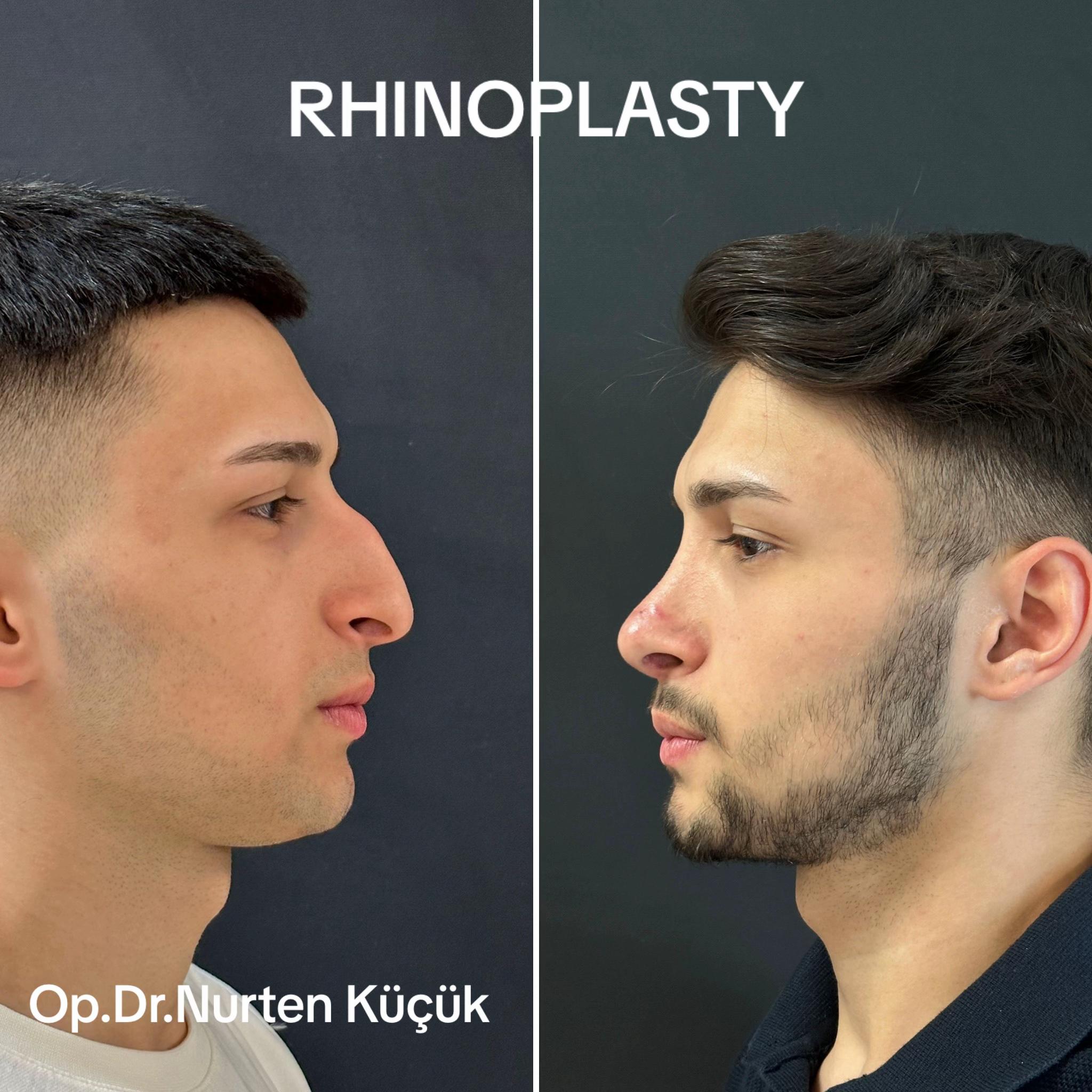 @Dr. NurtenKucuk
