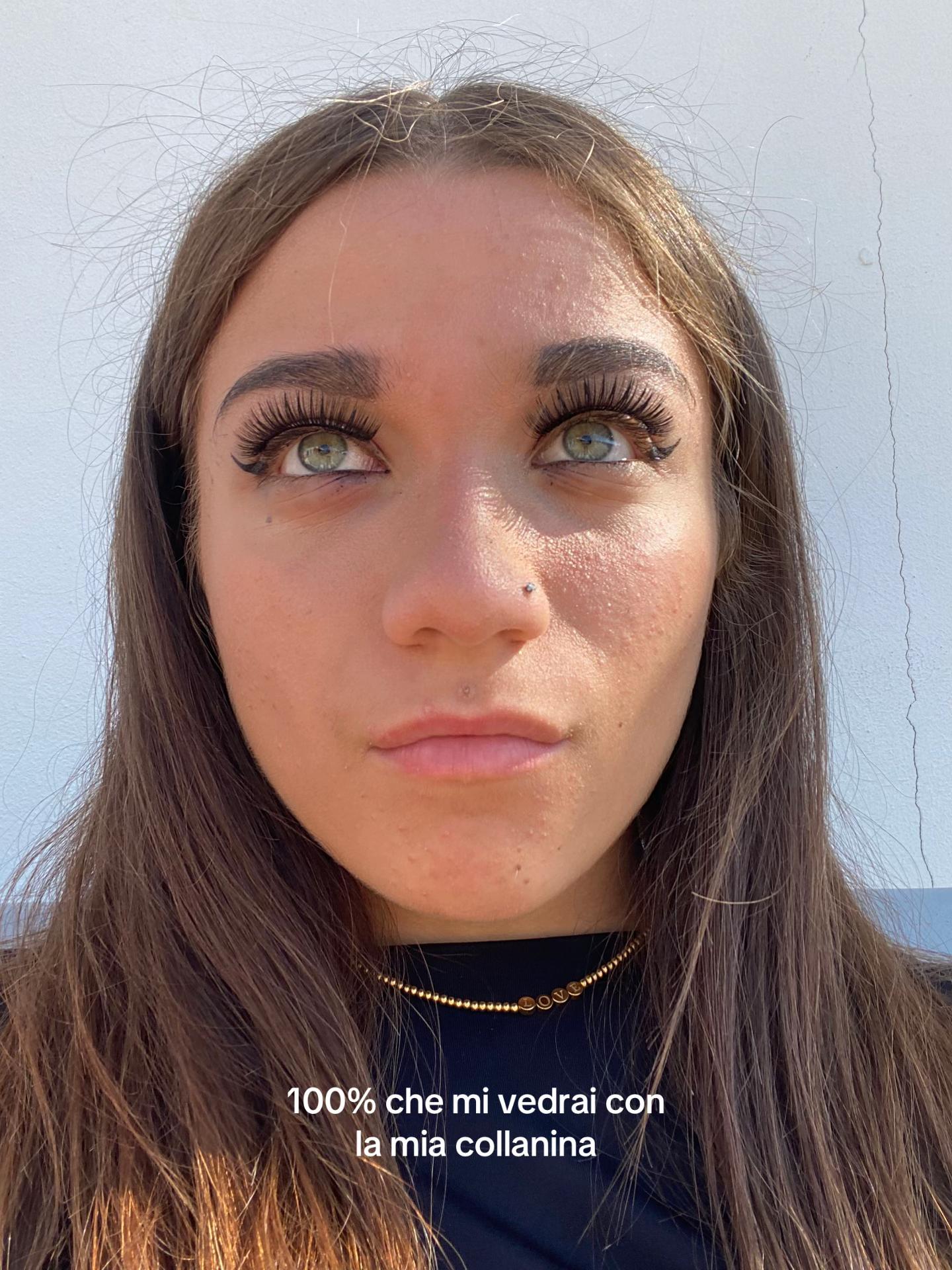 @ale