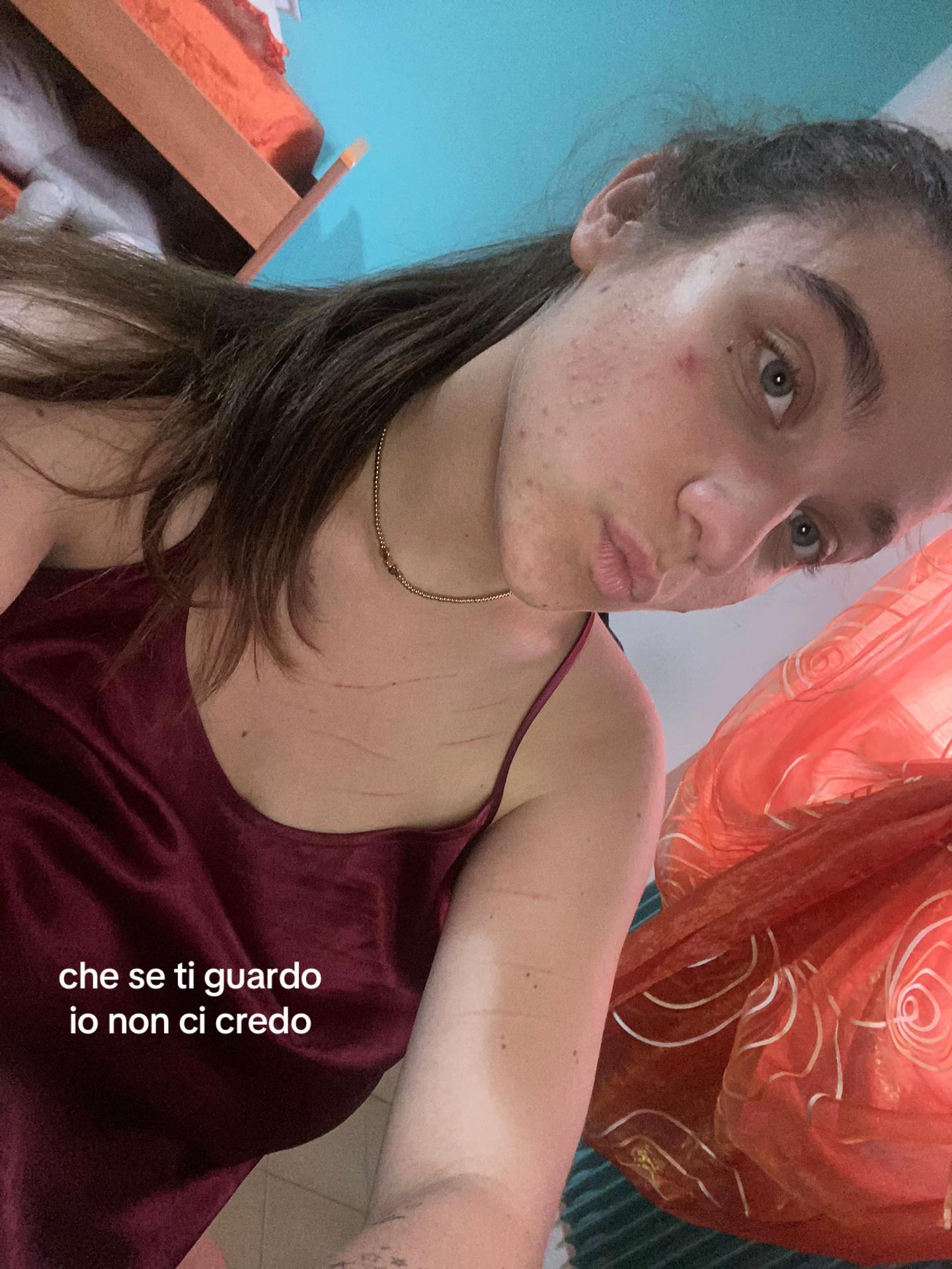 @ale
