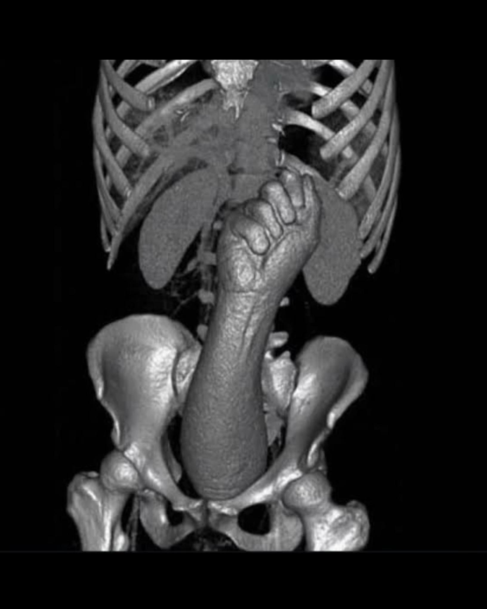 @Sobat Radiology